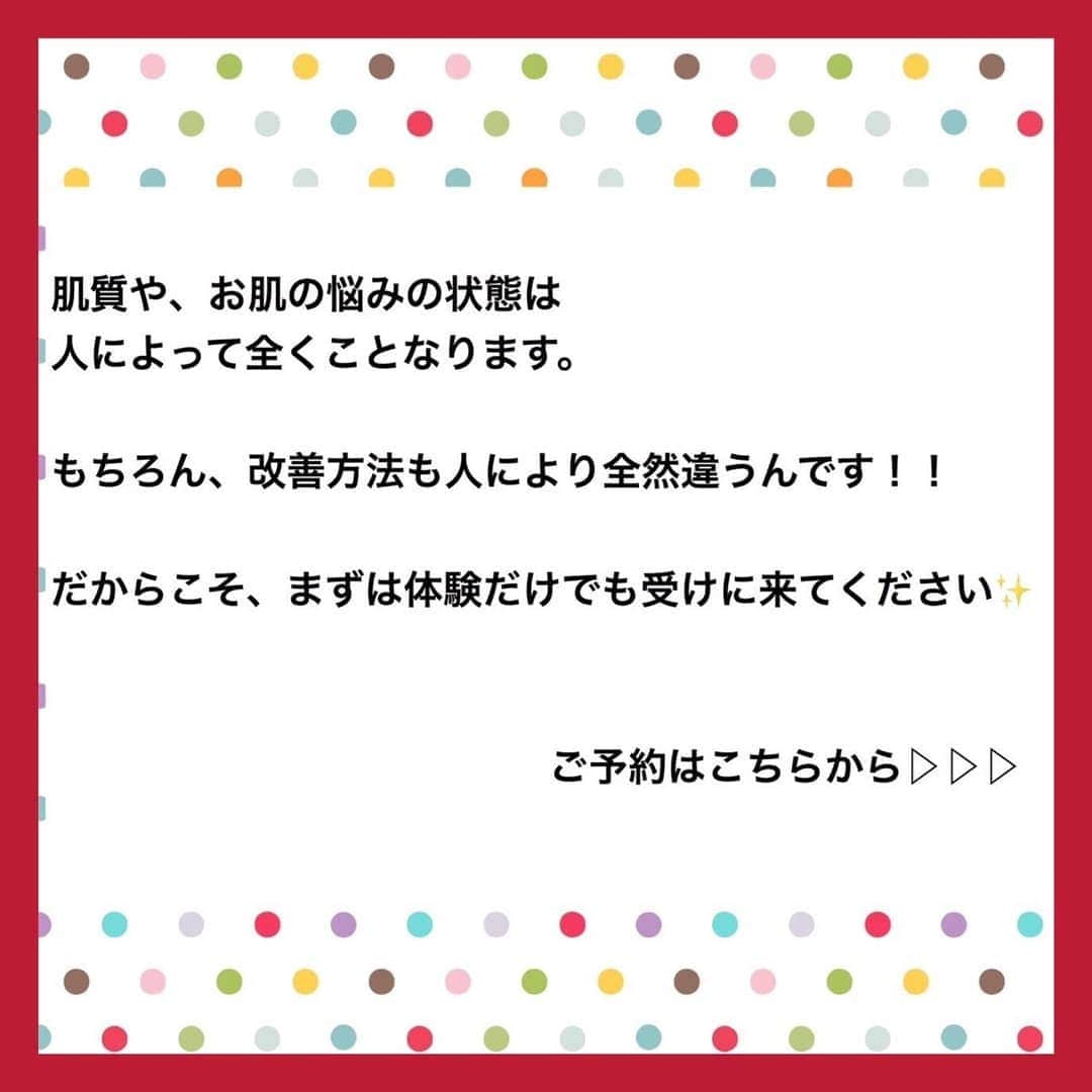 肌質改善専門サロン~Accueil~さんのインスタグラム写真 - (肌質改善専門サロン~Accueil~Instagram)「💙💚❤️8/20 空きあり* * 【ご予約はこちら👇🏼】 🌟🌟 @accueil_ikebukuro 🌟🌟 . ※今だけ期間限定クーポンあり . . . 肌荒れの原因は人それぞれなのにも関わらず、 周りの人と同じケアをしていませんか💦？？ * ❌お薬を塗っても飲んでも変わらない、、 ❌食事を気にしても肌が荒れる、、 ❌スキンケアを変えてもイマイチ、、 ❌何かしら常にトラブルが肌にある、、 ❌ニキビが繰り返しできる、、 * * そのお悩み解決できちゃいます😌✨ Accueilは、どのサロンに行っても良くならなかったお客さまたちや、 どの皮膚科に行っても変化がなかったお客さまたちが多く訪れてくださっています🙌💕* * * * もう悩まない！！！ 繰り返さないところまでしっかりと根本改善していきます☺️ そろそろ肌荒れから卒業しませんか？ * →→→初回体験はこちらから👉🏼 @accueil_ikebukuro * * * * Accueilでのお手当は、、 * 機械は一切使いません🙅‍♀️❌ 使うお化粧品は １００％天然の「ミネルヴァ化粧品」🌲🍃 ニキビの炎症がある方・アトピーの方でも 安心して受けていただける事ができる お肌にとても優しいエステです♡♡ * * お肌のお悩みなら、何でもお任せください😊💕 * * ■「インスタ見ました！」 で、 初回体験￥26,000 →→✨￥５，９８０✨ * * * --------当サロンのご予約方法≫--------- *  1️⃣当サロンのインスタTopのURL ⭐『Hotpepper Beauty』の 「instagram限定クーポン」にてご予約可能♡♡ * * 2️⃣インスタのDMからご予約 （下記項目を記載の上、お問い合わせください♪） * 🔶お名前（フルネーム） * 🔶お電話番号 * 🔶希望日時（第１～第３希望） * 🔶ご希望のメニュー * * 3️⃣お電話でのご予約✨ 　03-6912-5705にお願いします♡ ----------------------------------------- * * @accueil_ikebukuro ✨ #ニキビ #ニキビ跡 #毛穴 #乾燥肌 #ニキビ跡ケア #肌荒れ #ニキビ跡改善 #ニキビ肌改善 #ニキビ治療 #保湿 #毛穴の黒ずみ #毛穴の開き #スキンケア #毛穴吸引 #アトピー女子 #ニキビ皮膚科  #美肌ケア  #ニキビ専門 #肌質改善 #背中ニキビ #アトピー肌 #乾燥 #ニキビケア #毛穴ケア #アトピー治療 #肌悩み #スキンケア難民 #肌トラブル改善 #スキンケア大事 #目指せ美肌」8月19日 19時56分 - accueil_ikebukuro