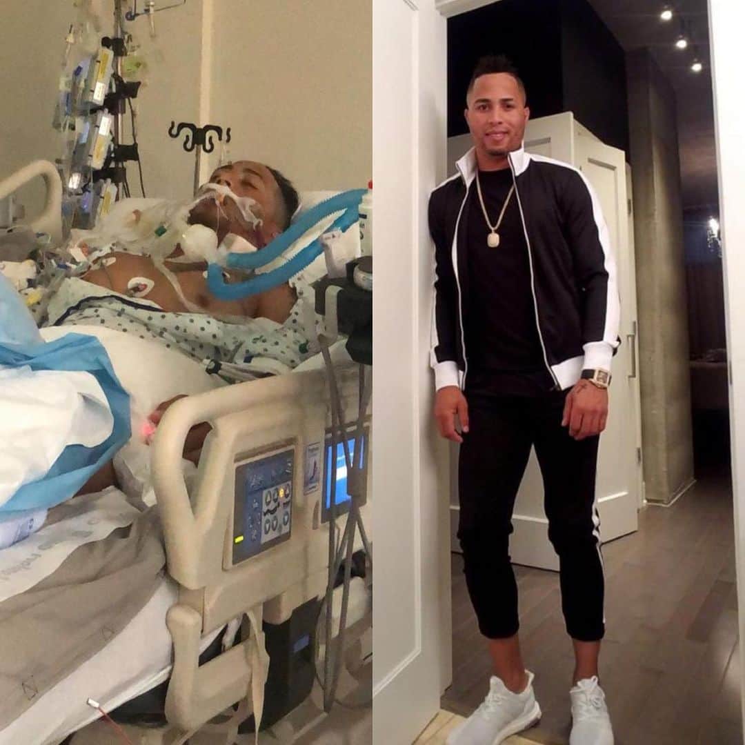 レオニス・マーティンのインスタグラム：「One year ago today and now. Grateful for my fans and anyone who prayed for my recovery」