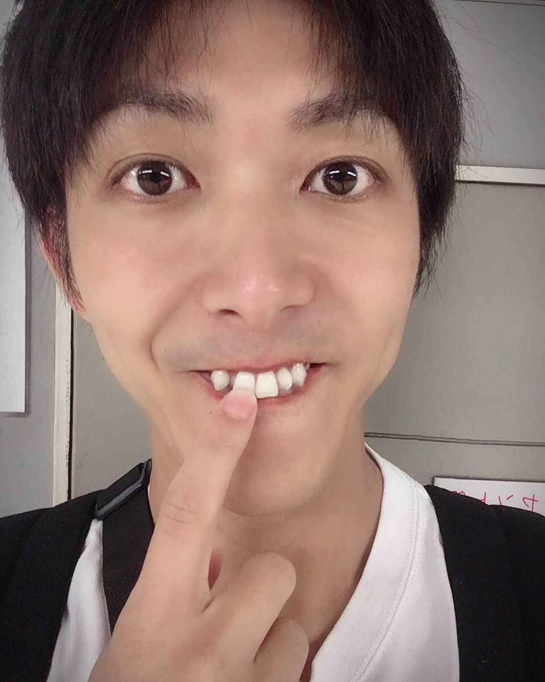 宮澤志暢さんのインスタグラム写真 - (宮澤志暢Instagram)「今日は…  8月22日。  8(は) 2(に) 2(つ)いてるよ  歯についてるよの日。  ご飯の後、食べたものが歯についていて気づかないことってありますよね？  私は歯並びが良くないこともあり、歯についちゃってる事がよくあります。  みなさんはそんな人を見たときどうしますか？  一声かけるか、恥をかかせちゃうかもしれないから言わないか…  さりげなく伝えられたら一番かもしれませんが、伝えるか伝えないか…  言われたい人もいれば、言われたくない人もいるから悩むとこですよねー。。。 でも、言ってみないとわからない！！ 言って嫌な気持ちになってしまったら謝る！その人だって、食べ物歯にくっついたままは嫌なはずです！  まずは、やってみましょう(*´U`*) ということで、今日は「歯に○○ついてますよ」と積極的に伝える日w  いやどんな日だよ！ってなるけど…とにかく！迷ってたって何も始まらない！！ さぁ！立ち上がれ！  勇気を出そう！！ #今日はなんの日 #歯についてるよの日 #言うべきか言わないべきか #デリカシーは必要 #いい方法あれば教えて #共有したい」8月22日 6時08分 - shinobu.miyazawa