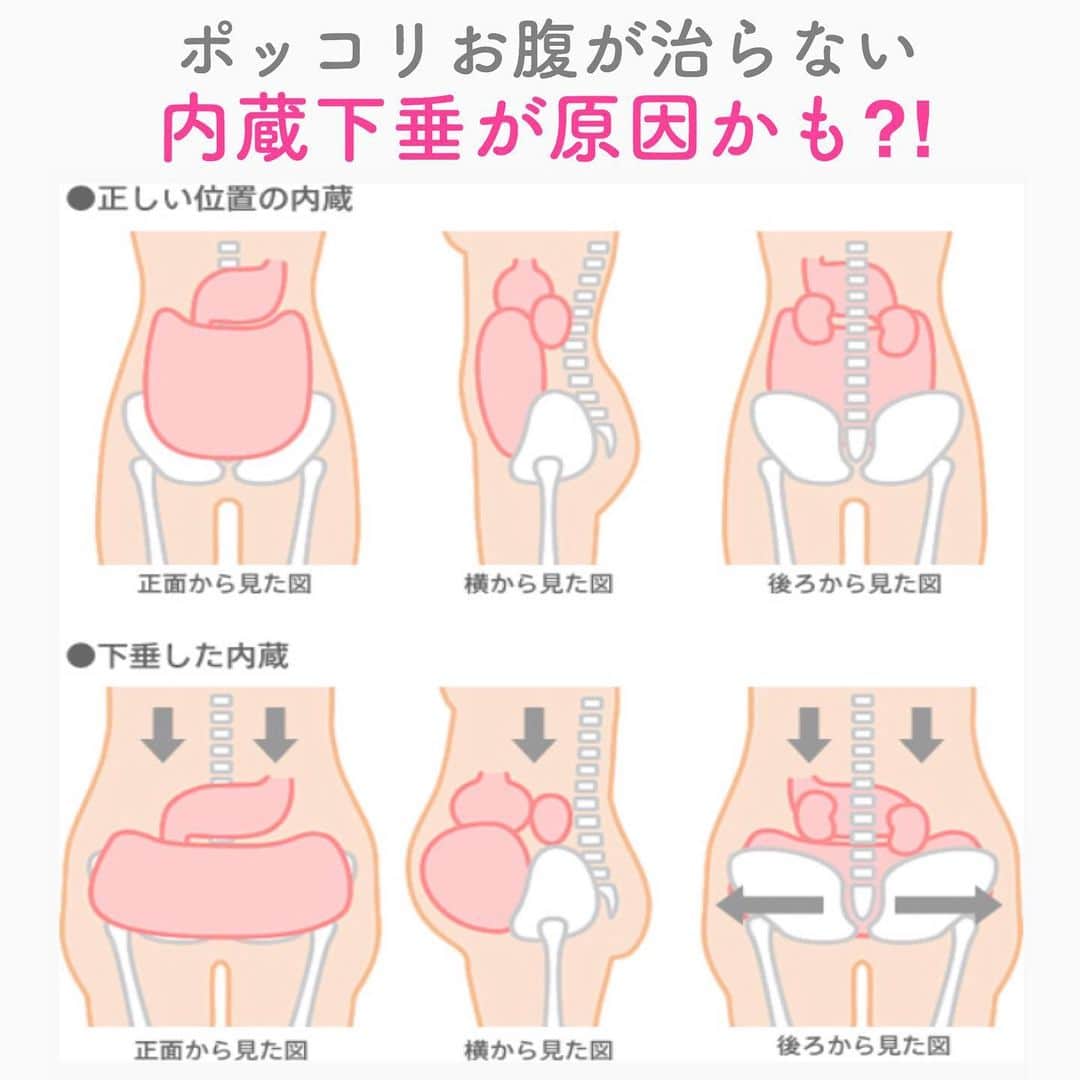 笑顔をリフォームする@健康小顔職人のインスタグラム：「． 内蔵下垂とは、内臓が骨盤内に下がり骨盤内は大渋滞、骨盤は開いた状態に。骨盤の広がりと共に、ウエストは年々太くなり、それと同時に、太ももやお尻など下半身も全体的にデップリしてきます。 ． また、内蔵が下がったことで腸が圧迫されてうまくぜん動運動ができなくなり「下痢」や「便秘」なりやすくなります。 ． そこで、下がった内蔵を元の位置に戻すポーズをご紹介します！ ． 壁を利用した「肩立ちのポーズ」です。 ． 【肩立ちポーズのポイント】 ・骨盤はできるだけ壁に近づける ・肩は床にしっかりつける ・首の後ろを長く保つ ・胸はゆったりと開く ・（両手をバンザイしてる場合は）ひじを軽く曲げる ・目は（できるだけ）閉じてリラックス ・30秒〜5分（無理のない範囲で行いましょう） ． 肩立ちのポーズは足のむくみにも良いです。楽な気持ちで少しずつやってみてくださいね！ ． ． 今日も皆様にとって笑顔溢れる一日となりますように✨ ． ． 💆🏻‍♀️心美体を整える「小顔整顔トリートメント」 👰ブライダル小顔🤰マタニティ小顔＆足リフレ ♨️代謝を上げる「Hot&Coldストーンリンパマッサージ」 ご予約はプロフ🔗→HP→予約サイトへ！ ． ． ✨気を整えて心と体を健康に！チャクラエネルギーセラピー ※Hペッパー等の予約サイトからは予約できません。ご予約は必ずホームページからお願いします(プロフ🔗) ． ． 🍀リフトアップクリーム&ボタニカルオイル ネットショップにて発売中 https://yushian.thebase.in/ baceアプリ→小顔職人で検索🔍 ． ． 💟あなたも小顔職人になれる👍 小顔職人養成スクール！9月スタート☆ スクール生募集中。応募締切8/25迄 詳細・お申込はプロフ→HP→小顔養成スクールへ！ ． ． ☪️私スピリチュアルワークショップ ◉内山エナさん9/8(日)空席あり ◉さときちさん9/10(火)空席あり ． ． #幸せはいつも自分が連れてくる #笑顔は世界を明るくする #皆んなでハッピーになろう #自分を愛そう #世界が愛で溢れますように #自然治癒力は素晴らしい  #健康な小顔になろう #体温を上げて代謝を上げよう #心身共に整ってこそ美容 #笑顔をリフォームする小顔職人 #いつもご覧頂きありがとうございます  #happylife #happiness #happysmile #health #Wellness #wellnessblogger #loveyourself」