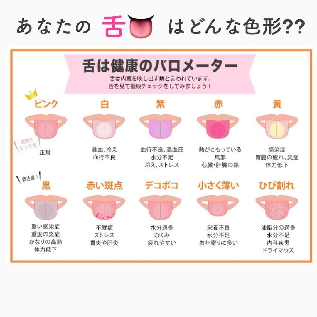 笑顔をリフォームする@健康小顔職人のインスタグラム：「． 舌👅の色や形で健康状態を知ることができます。 ． ⑴色 血流の動態や身体の温度がわかる。色の基準がわかりづらい場合は、家族などほかの人と比べてみるとよい。 ． ⑵大きさ、形 体液（水分量）の状態、つまり乾燥ぎみかむくみぎみかがわかる。シワが濃くなっていないか、いつもより大きくなっていないかなどを確認。 . ⑶舌苔（ぜったい）の状態 体液の粘張度がわかる。舌苔の量や色、まだらになっていないかを見ること。 ． ⑷舌の裏の血管 身体のなかで唯一、直視できる静脈（舌下静脈）を見て血流の疎通状態を確認。形や色、左右差の有無をチェック。 ． ⑸舌の動き 自律神経の働きを確認。リラックスした状態であっかんべーをし、まっすぐ出せるか、余計な力が入らないかがポイント。 ． いかがでしたか？ 病院で「舌を見せてください」というお医者様がいらっしゃいますが舌の色や形を見て、この様に診断されているんですね〜。 ． ． 今日も皆様にとって笑顔溢れる一日となりますように✨ ． ． 💖小顔セミナーin HDC大阪！9/19(木)18:30〜 無料！関西地区の皆様！お会い出来ること楽しみにしています❤︎ ． ． 💆🏻‍♀️心美体を整える「小顔整顔トリートメント」 👰ブライダル小顔🤰マタニティ小顔＆足リフレ ♨️代謝を上げる「Hot&Coldストーンリンパマッサージ」 ご予約はプロフ🔗→HP→予約サイトへ！ ． ． ✨気を整えて心と体を健康に！チャクラエネルギーセラピー ※Hペッパー等の予約サイトからは予約できません。ご予約は必ずホームページからお願いします(プロフ🔗) ． ． 🍀リフトアップクリーム&ボタニカルオイル ネットショップにて発売中 https://yushian.thebase.in/ baceアプリ→小顔職人で検索🔍 ． ． 💟あなたも小顔職人になれる👍 小顔職人養成スクール！スクール生募集中！詳細・お申込はプロフ→HP→小顔養成スクールへ！ ． ． ． ☪️スピリチュアルワークショップ ◉内山エナさん9/8(日) ◉さときちさん9/10(火)・25(水) 詳細・お申込はプロフ→HPへ ． ． #幸せはいつも自分が連れてくる #笑顔は世界を明るくする #皆んなでハッピーになろう #自分を愛そう #世界が愛で溢れますように #自然治癒力は素晴らしい  #健康な小顔になろう #体温を上げて代謝を上げよう #心身共に整ってこそ美容 #笑顔をリフォームする小顔職人 #いつもご覧頂きありがとうございます  #happylife #happiness #happysmile #health #Wellness #wellnessblogger #loveyourself」
