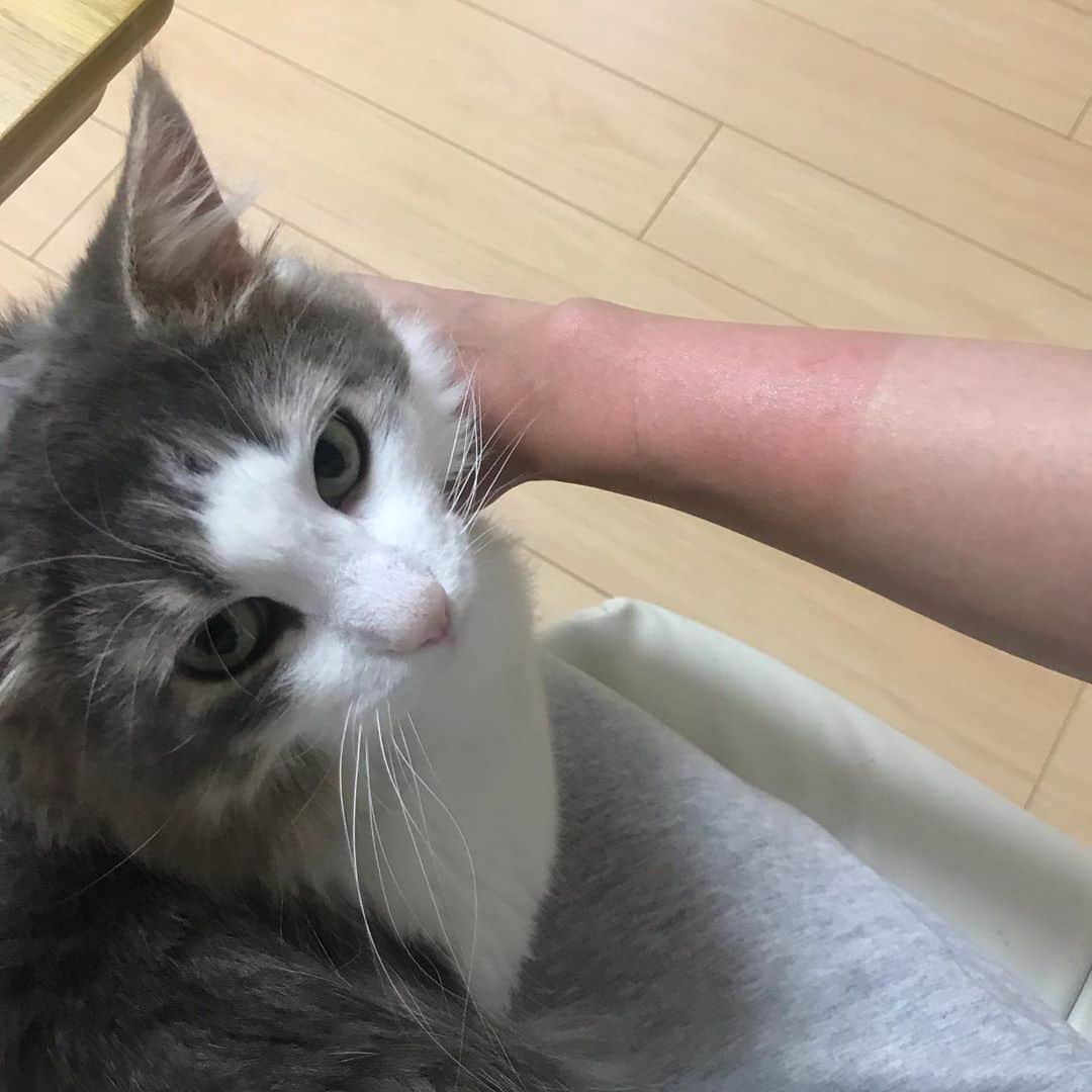 三好春奈のインスタグラム：「式根島から帰ってきて2日。うっかり焼けしたモンスターボールのような腕はまだ赤みが引かないし火傷状態でこすれると激痛…鼻の頭も同じ状態😭明日ライブでこれはやばい…」