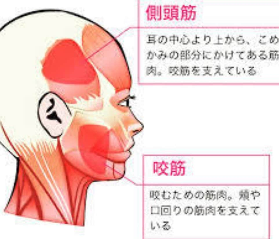 兼子ただしさんのインスタグラム写真 - (兼子ただしInstagram)「兼子ただしが世に送り出す新商品、 『ストレッチ教材』はいくつかの案を水面下で準備をしている。 現代人の身体機能を向上させる商品をいくつか模索している。それのサンプルが届いた。  まずは『顔面の筋肉』をストレッチするもの。 噛み合わせ（咀嚼）の筋肉をストレッチする事で、慢性的な首コリの解消と小顔効果が期待出来るもの。  意外と多くいらっしゃる『食い縛り』の方。 食い縛りの筋肉の『咬筋』と『側頭筋』 ここの筋肉の緊張は、三叉神経や副神経の緊張を誘発する。 ここをストレッチすると顔が小さくなる。  実際に兼子がストレッチをすると、 すぐに効果が目で見てわかる。 （サンプル商品は未使用の結果）  顔はなかなか鍛えられない。 しかし顔もストレッチする時代になる。  この商品の完成はまだ先だが、 食い縛りの問題『咬筋』と『側頭筋』はストレッチを継続的にしていきたいものだ。  どう？ この商品、欲しいでしょ？？」8月28日 9時08分 - kanekostretch