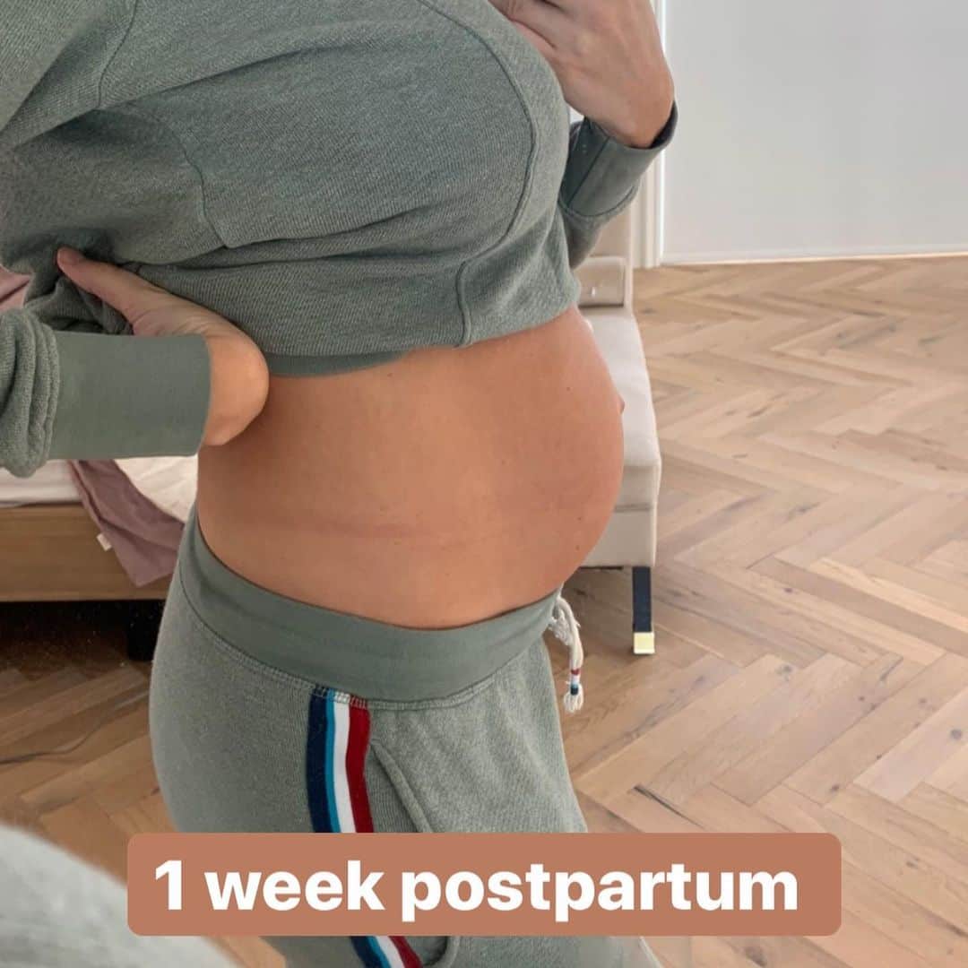 Amber Fillerup Clarkさんのインスタグラム写真 - (Amber Fillerup ClarkInstagram)「9 months pregnant // 6 months postpartum 🤰🏼and swipe to see 1 day PP and 1 week PP! I know it is so cliche to say but geez how crazy are our bodies?! It’s amazing. I wanted to post these progress pictures because where I saw the most changes was when I started doing keto with my hubby. He has done the keto diet on and off for 9ish years.. ever since I met him he has done it. He feels really good when he does it so he has just continued to do it. I am the type of person that if I’m going to have a cookie I’m gonna have a few 😂 and during my pregnancy I ate pretty much what I felt like while trying to make healthy choices.. but I have a maaaajor sweet tooth. I gained 50lb with each of my pregnancies. So that has been the biggest change for me with keto is 1. Feeling so good being off carbs and sugar and 2. Seeing the most results to lose the baby weight I put on - just to feel strong and healthy. I’m super proud of my husband @davidavidavid because he has been working really hard on putting together a keto meal plan with all of our favorite recipes. He will be launching it a week from today so go follow him to see sneak peeks of the meals, insta stories of how he makes some of them, and just more things keto 💪🏻 I know it’s not for everyone but it works for us. *to answer the most common question I get - yes I’m still nursing! She drinks only breast milk - I nurse 90% of the time and the other 10% she gets breast milk from a bottle from David while I’m at work.」8月29日 3時44分 - amberfillerup
