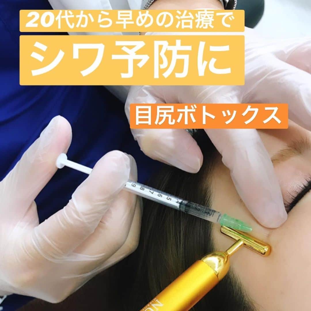東京美容外科公式さんのインスタグラム写真 - (東京美容外科公式Instagram)「東京美容外科赤坂院です。 本日は表情ジワにも効果的な『ボトックス治療』のご案内です。 ボトックスは、筋肉の収縮を抑制することで「しわの予防」や、すでに出来てしまった「しわの改善」をすることが出来る注射治療です！ 20代や30代の、しわが出来きる前からの早めの治療がおすすめです。 多くの患者様が1回の注射で効果を実感していただいております✨ お時間もかからない簡単な施術ですので、お気軽にご相談下さいませ☺️ ===🎁お問い合わせはこちら🎁==== 詳しくはプロフィールのURLから公式サイトへ♪ ▼フリーダイヤル 0120-658-958 （コールセンター受付時間：9：00～21：00） ▼LINE予約 @ tkc110 #東京美容外科 #東京美容外科赤坂院 #赤坂 #港区#美容 #美容整形 #きれい #整形 #美活 #綺麗になりたい #美肌 #美意識  #美容外科 #プチ整形 #韓国  #エイジングケア #アンチエイジング #美容好き #韓国美容 #美容整形外科 #二重 #埋没法 ===🎁お問い合わせはこちら🎁==== 詳しくはプロフィールのURLから公式サイトへ♪ ▼フリーダイヤル 0120-658-958 （コールセンター受付時間：9：00～21：00） ▼LINE予約 @ tkc110 ========================= #東京美容外科 #東京美容外科赤坂院 #赤坂 #港区#美容 #美容整形 #きれい #整形 #美活 #美肌 #美意識  #美容外科  #エイジングケア #アンチエイジング #美容好き #韓国美容 #美容整形外科 #皺 #しわ #ボトックス #しわ治療 #表情ジワ」9月25日 17時09分 - tokyobiyougeka_jimukyoku