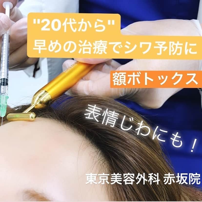 東京美容外科公式さんのインスタグラム写真 - (東京美容外科公式Instagram)「東京美容外科赤坂院です。 本日は表情ジワにも効果的な『ボトックス治療』のご案内です。 ボトックスは、筋肉の収縮を抑制することで「しわの予防」や、すでに出来てしまった「しわの改善」をすることが出来る注射治療です！ 20代や30代の、しわが出来きる前からの早めの治療がおすすめです。 多くの患者様が1回の注射で効果を実感していただいております✨ お時間もかからない簡単な施術ですので、お気軽にご相談下さいませ☺️ ===🎁お問い合わせはこちら🎁==== 詳しくはプロフィールのURLから公式サイトへ♪ ▼フリーダイヤル 0120-658-958 （コールセンター受付時間：9：00～21：00） ▼LINE予約 @ tkc110 #東京美容外科 #東京美容外科赤坂院 #赤坂 #港区#美容 #美容整形 #きれい #整形 #美活 #綺麗になりたい #美肌 #美意識  #美容外科 #プチ整形 #韓国  #エイジングケア #アンチエイジング #美容好き #韓国美容 #美容整形外科 #二重 #埋没法 ===🎁お問い合わせはこちら🎁==== 詳しくはプロフィールのURLから公式サイトへ♪ ▼フリーダイヤル 0120-658-958 （コールセンター受付時間：9：00～21：00） ▼LINE予約 @ tkc110 ========================= #東京美容外科 #東京美容外科赤坂院 #赤坂 #港区#美容 #美容整形 #きれい #整形 #美活 #美肌 #美意識  #美容外科  #エイジングケア #アンチエイジング #美容好き #韓国美容 #美容整形外科 #皺 #しわ #ボトックス #しわ治療 #表情ジワ」9月25日 17時09分 - tokyobiyougeka_jimukyoku