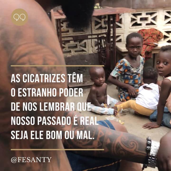 フェリペ・サンタナのインスタグラム：「O INCRÍVEL PODER DAS CICATRIZES!!! . Acredito que um ser humano que não tem cicatriz é um ser sem história. Algumas são traumatizantes, outras deformadoras que chegam a ser horripilantes, mas existem tbm cicatrizes transformadoras aquelas que te levam ao próximo level. Não acho que exista no mundo outro veículo de transporte com a mesma velocidade e precisão de uma cicatriz. O simples fato de olhá-la ou toca-la te coloca em fração de segundos no dia, na hora, e no exato segundo de sua criação!!! Por fim acho que seu grande PODER consiste na lição que ela te trás, seja ela negativa e destruidora, ou, uma positiva e alavancadora... VOCÊ QUEM DEFINE QUE PRESENTE PEGAR!!! . .  Se a sua PRINCIPAL for negativa deixa aí um (🙏🏿), agora se for positiva detona com (🤩)!!! Ahhhh e por favor não esqueça de ser feliz...」