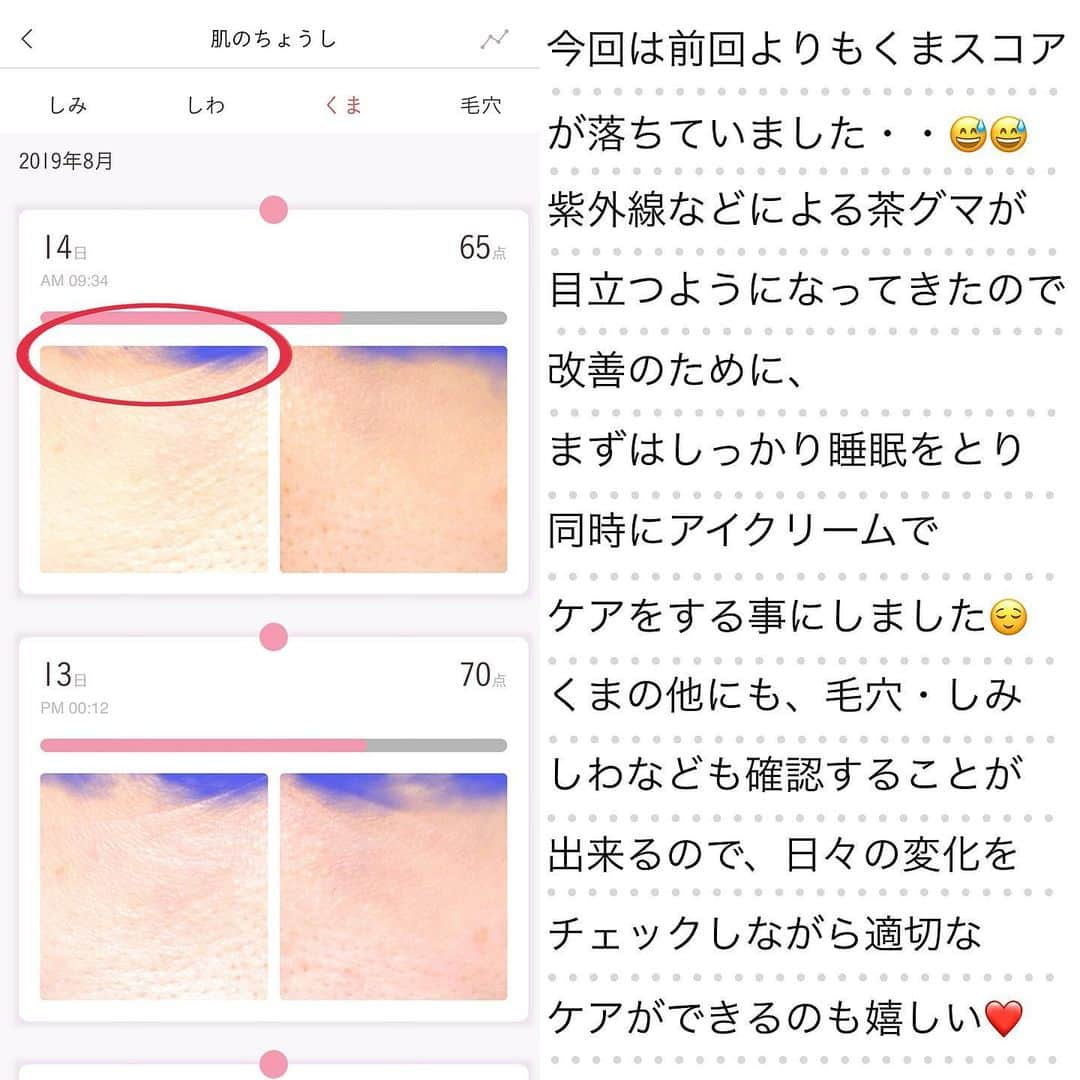 ささき ともみさんのインスタグラム写真 - (ささき ともみInstagram)「・ この夏にたっぷり浴びた紫外線の影響もあり、 最近は目の下のくまやくすみが目立ってきたので コンシーラーで頑張って隠しています🐻💦 ・ 実はこれまで目の下のケアは ほとんどしてこなかったんですが、 さすがにアラサーなので放っておけず・・😱 やっぱり素肌から綺麗になりたいので、 きちんとケアを始めてみる事にしました❗️✨ ・ 以前紹介させていただいたFACE LOGで 毎日肌のちょうしをチェックしているんですが、 思った通り「くまスコア」が下がっていました😭 写真2枚目です💡 ・ 改善に向けてまずは睡眠をしっかりとり、 美白効果のあるアイクリームを使い始めました👀✨ ELIXIRのホワイトエンリッチドリンクルホワイトクリームは 純粋レチノールが配合されているので 目元のシワもケアできて一石二鳥❤️ ・ 自分の肌状態をきちんと把握できていると ちょっとした変化にも気付けて 早めにケアすることが出来るので、 肌状態を知る事はとても大切だなと 改めて感じました😢💕 ・ ストーリーズにFACE LOGのリンクを貼っているので 是非活用してみてください☺️☺️ ・ ♡┈┈┈┈┈┈┈┈┈┈┈┈┈┈┈┈┈┈┈┈┈┈┈┈┈┈┈♡ #ドコモ#FACELOG#ヘルスケア#PR#iOS向けアプリ#facelog#肌解析#肌年齢#肌チェック#肌撮影#美肌#美意識#美容好き#肌荒れ#美肌ケア#エイジングケア#美肌レシピ#スキンケア#美白#アイクリーム」9月5日 10時09分 - tomomi_sasaki_