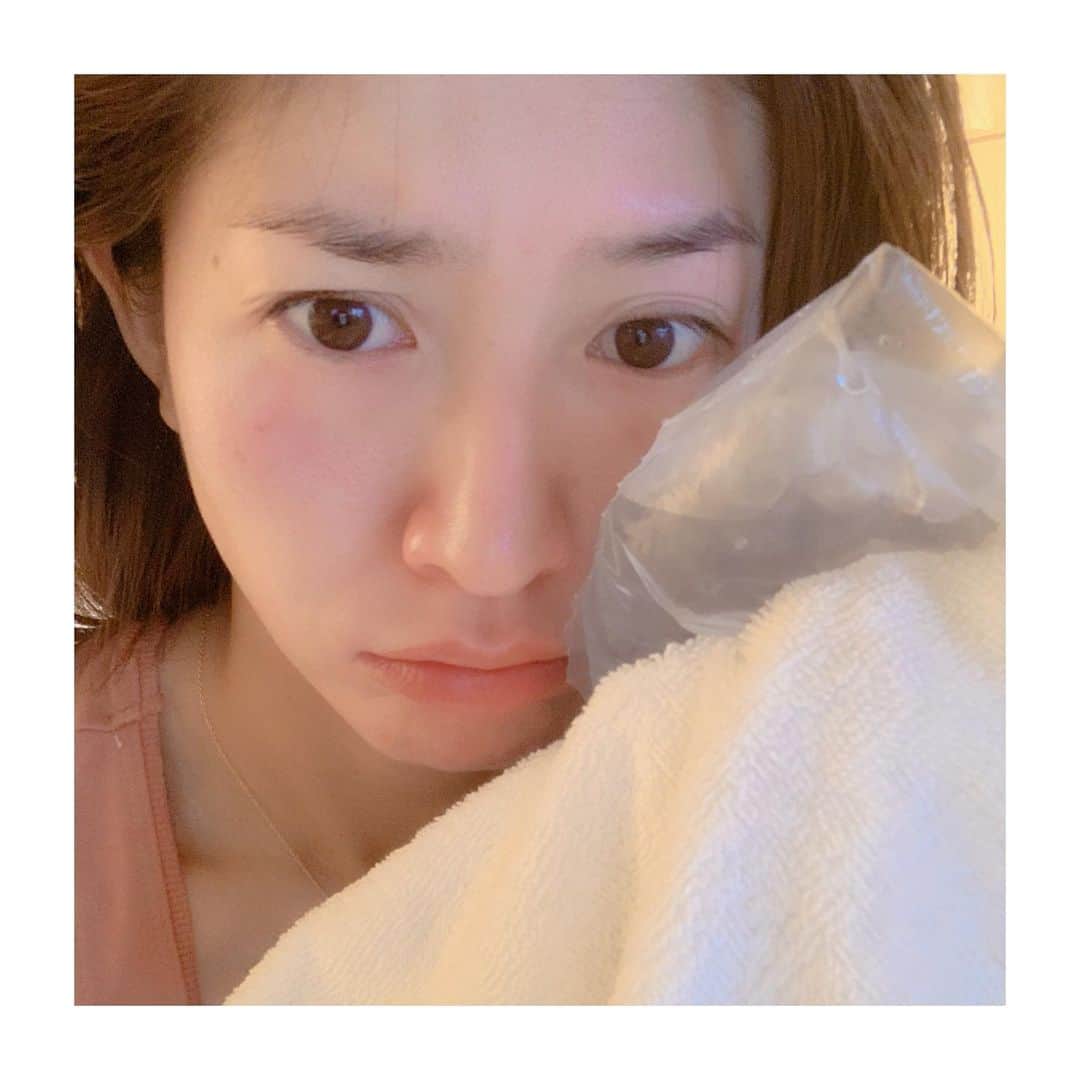 森下千里のインスタグラム：「アプリ使って、 ぶりっ子して写真撮ってますが、 やっちゃいました…  日焼け通り越して、 火傷😭😭😭😭 40手前のこれは、辛いっ！！！ とにかく、アイシング❄️ あっためろとか、 冷やせとか、 女の身体って、ほんとに忙しい…。 赤みが引いたら、今度は保湿。  頼むよ、自分💧 . . #日焼け #アイシング #beauty #美容 #美白 #美肌 #ほど遠い」