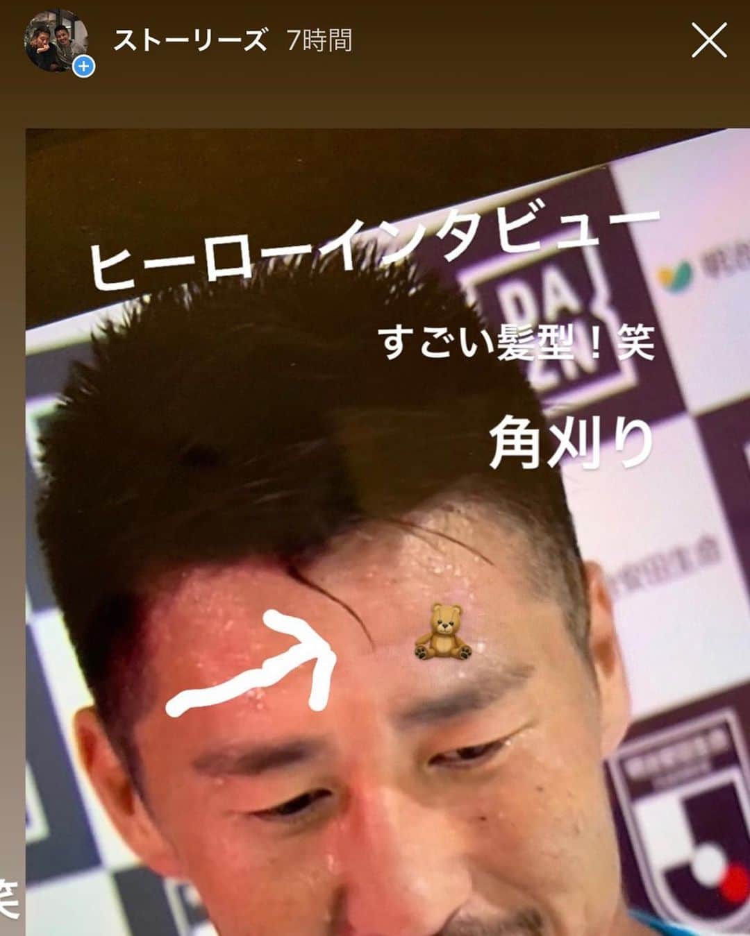 のインスタグラム：「ストーリーズ。早く消えますように。  #谷口博之のストーリーズ #突然の投稿 #どうした #それでもひるまない豊田 #これは幽遊白書 #ではない #これはベッカムスタイルだ #ベッカムより多めに #作ったぜ #ちょろ毛 #デコにはベアーも乗せたぜ #ベアーさん #床がすべりやすくなっております #透明な汗で #いや #黄色ーいたぶんー #ヒーローインタビュー  #そうだ散髪へ行こう」