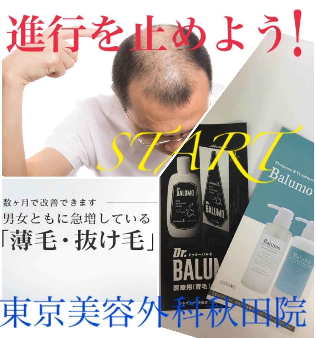 東京美容外科公式さんのインスタグラム写真 - (東京美容外科公式Instagram)「秋田院の人気の１つでもある 発毛治療です❗️ 男女問わず治療できます☝️ . 薄毛で悩んでいる方や抜け毛が気になる方 なかなか人には言えない悩みですよね🤭 . 是非、秋田院にご相談ください😊 . ==🎁お問い合わせはこちら🎁==== 詳しくはプロフィールのURLから公式サイトへ♪ ▼フリーダイヤル 0120-658-958 （コールセンター受付時間：9：00～21：00） ▼LINE予約 @ tkc110 ============== #東京美容外科 #東京美容外科秋田院 #審美 #美容整形 #きれい #整形 #美活 #綺麗になりたい #美意識  #美容外科 #秋田#美容好き#発毛治療薬#発毛#薄毛#抜け毛#AGA#9月＃9月8日#秋田の残暑」9月8日 17時44分 - tokyobiyougeka_jimukyoku