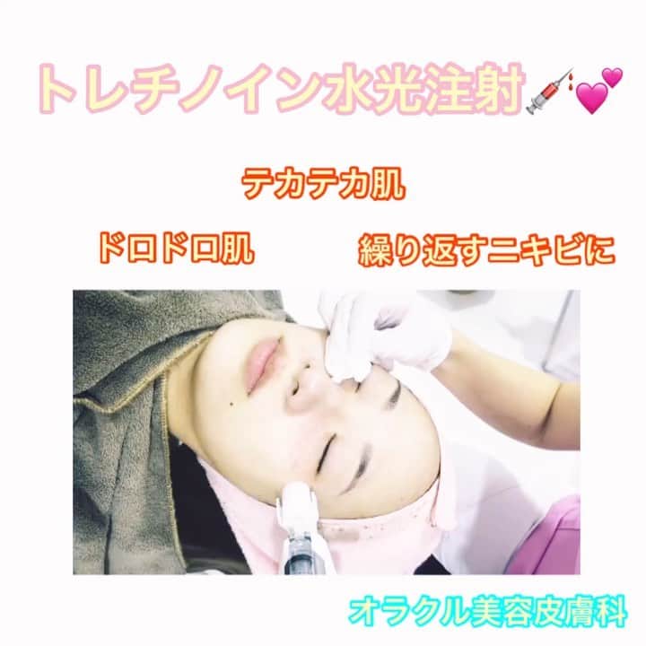 オラクル美容皮膚科東京新宿院のインスタグラム