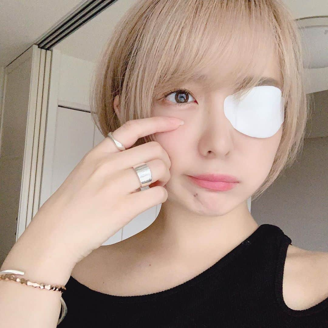 中野佑美さんのインスタグラム写真 - (中野佑美Instagram)「俺の右目が火を噴くぜって感じになっていますが麦粒腫です」9月11日 17時54分 - nakan084