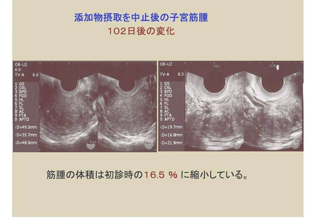 埼玉エステ＊インディバ＊戸田公園＊戸田市＊痩身＊冷え改善のインスタグラム