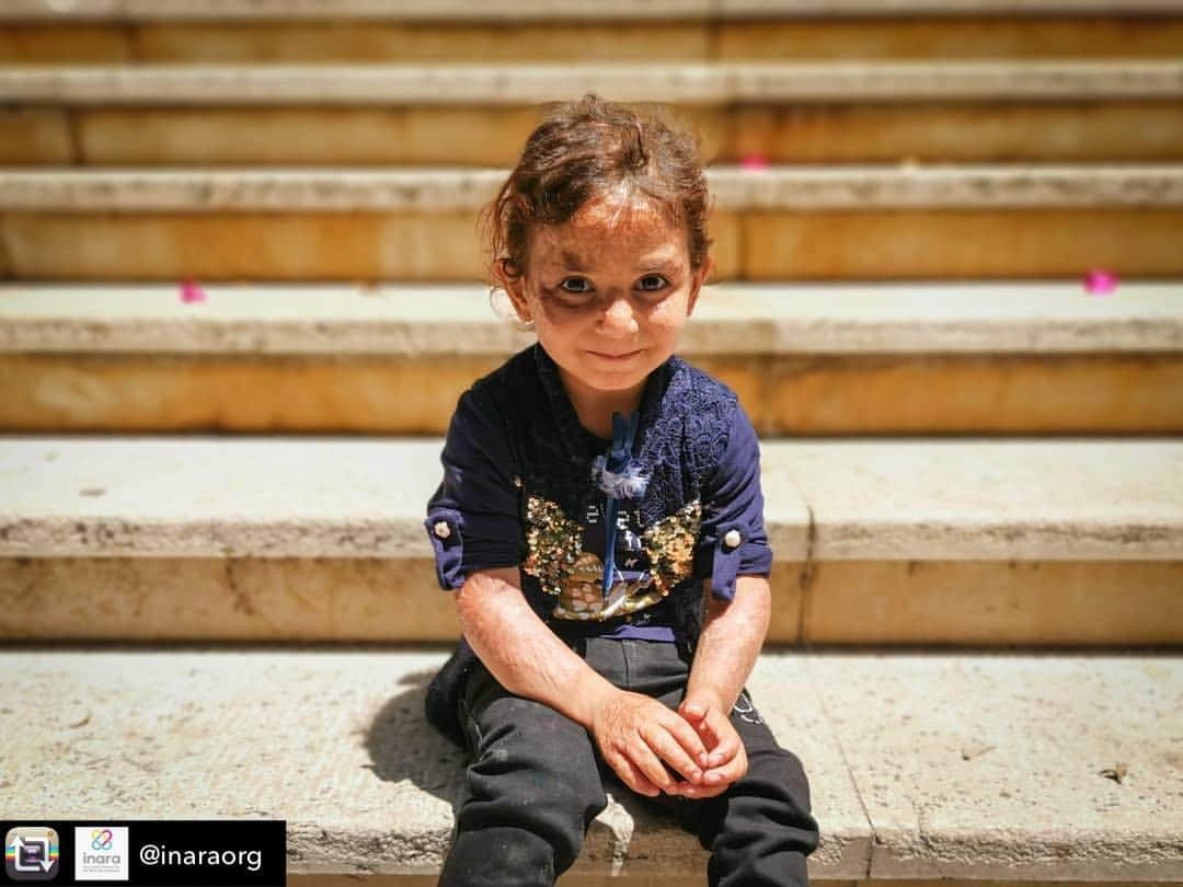 トーマス・サドスキーさんのインスタグラム写真 - (トーマス・サドスキーInstagram)「The horror of war does not stop just because it isn’t in the headlines. Our mission has just begun. Please help us help these kids.  Repost from @inaraorg - There are so many new cases to introduce you to this September. Our latest is Amira. Her face, arm and hand were badly burnt in a fire in the refugee camp her family live in in Lebanon. Her brother was killed in the fire. It's hard to imagine what her family have been through but you can begin to help by donating today... . . #inara #arwadamon #thomassadoski #amandaseyfried #unicef #aubmc #love #peace #syrian #syrianrefugees #compassion #pray4syria #idlib #thursdaythoughts #charity #ngo #nonprofit #childreninneed #refugeeswelcome #refugeehealth #refugeecamp #lebanon #refugeesinlebanon #turkey #refugeesinturkey #gaziantep #beirut」9月12日 22時29分 - thomas_sadoski