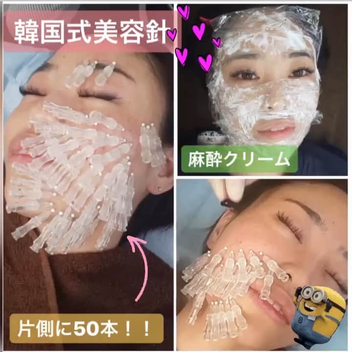 恵比寿フィラークリニックのインスタグラム