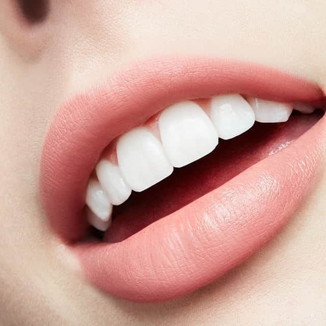 M∙A∙C Cosmetics Japanのインスタグラム：「⠀ IZ*ONEがまとうM·A·CのLOVE ME LIPSTICK #MACXIZONE ⠀ リップスティックの柔らかなテクスチャーからインスパイアを受けて”LOVE ME SOFTLY” をテーマにメンバー12人が異なるリップカラーをまとい、媚びないフェミニンな女性像を表現 ⠀ 左から 1枚目💄トレ ブラーゼイ（SAKURA使用色） 2枚目💄ヴァニティ ボンファイア（CHAE YEON使用色） 3枚目💄メゾン ルージュ（HYE WON使用色） 4枚目💄ナイン リブズ（YE NA使用色） ⠀ 9/18（水）～10/16（水） M·A·C公式オンラインショップ, 全国のM·A·C店舗にて NYLON JAPANと連動した限定ビジュアル4種が店舗別に展開します✨ ⠀ さらに期間中LOVE ME LIPSTICK(全24色対象)を含む税込6,480円以上(10/1（火）～税込6,600円以上) をお買いあげの方に製品パッケージからインスパイアされたLOVE MEキーチェーンをプレゼント致します。 ⠀ *なくなり次第終了となります *お1人様1会計につき1個までとなります *全部で3色展開ですが、色はお選び頂けません ⠀ ⠀ ⠀ ⠀ ⠀ #MACCosmeticsJapan #MACコスメ #MACCosmetics #MAC #MACLoveMe #MACラブミー #MACリップ #IZONE #アイズワン #아이즈원 #リップ #キャンペーン #NYLONJAPAN #NYLONJP」