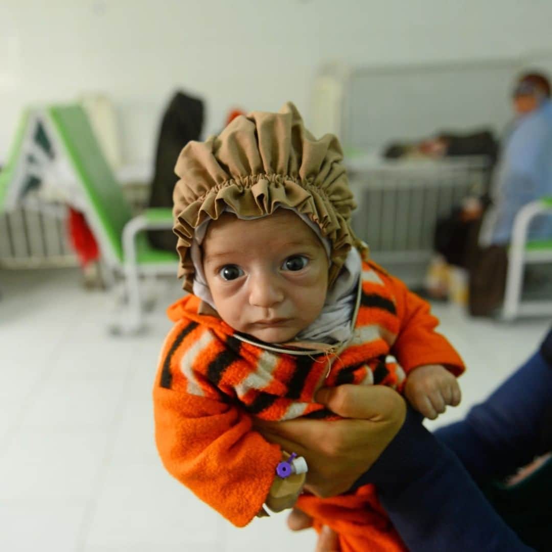 unicefさんのインスタグラム写真 - (unicefInstagram)「Rasool, two months, is being treated for malnutrition at a UNICEF-supported hospital in Herat, Afghanistan. She’s one of 29 million children who were born into a conflict zone last year.  Armed violence is robbing families of the nutritious food, safe water and secure environments they need to grow and bond. We must invest in better support for #ChildrenUnderAttack.  #EarlyMomentsMatter © UNICEF/UN0280721/Hashimi AFP-Services」9月22日 21時50分 - unicef