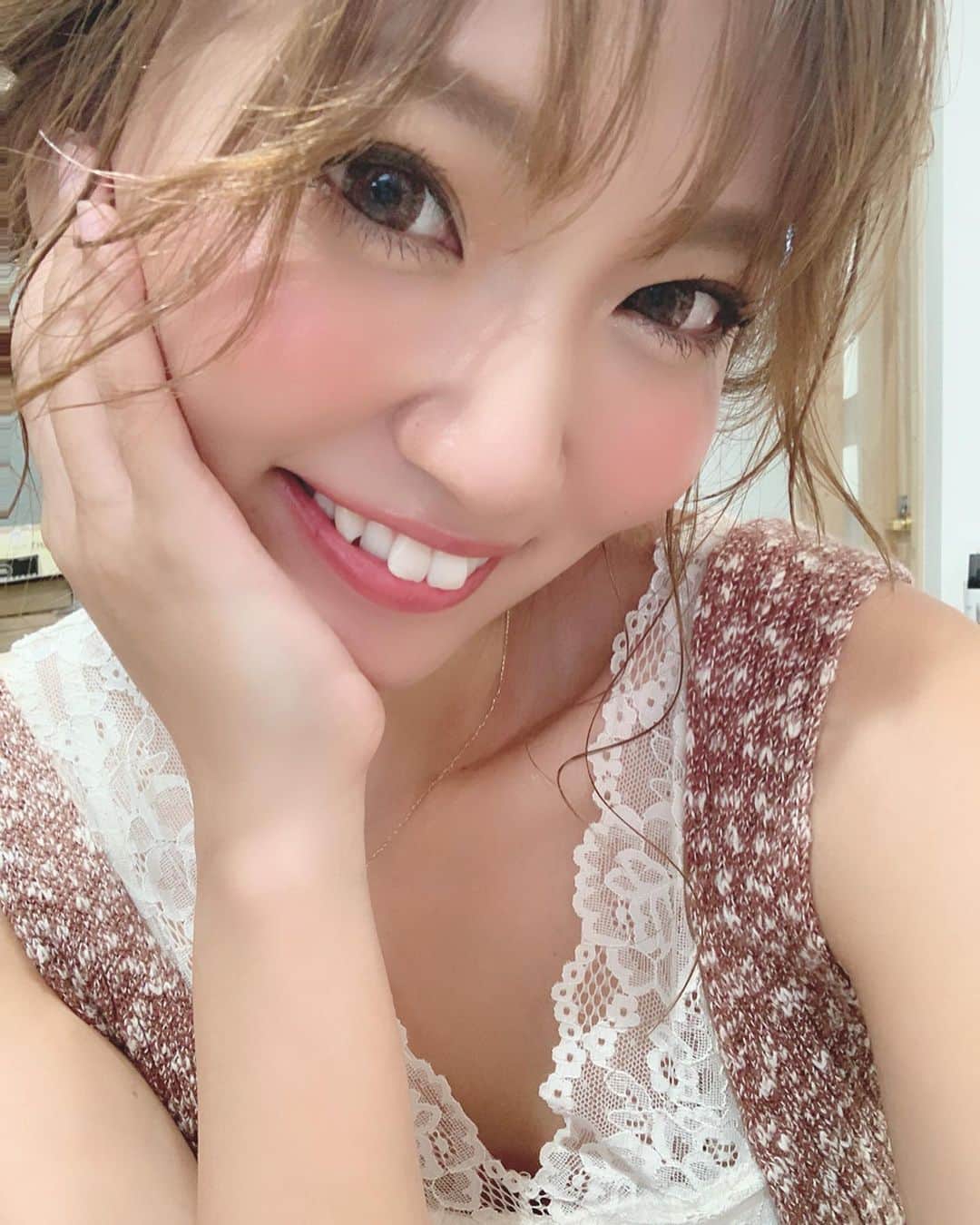 いっちゃん/嶋津 いつみのインスタグラム：「. . ねぇ。みんな…私の前歯が出てるの知ってるやん？😬💕w . . . . 人より目立つわけよ🙄💨 . . やからお家で出来る @pearlwhitepro  で ホワイトニングを始めてみたー✨ . . . . 始めて1ヶ月やねんけど どうｯｯ!!これ!!😳⭐️ . . 目で見てわかるぐらいに白くなってるよな❤️❤️❤️ . . . . 使い方も歯磨きの後に 3滴ぐらいたらしてブラッシングするだけやから ズボラな私←👻 でも続けられてる💓ww . . . . . #ホワイトニング #ノー歯医者  #歯磨きスマイル #パールホワイト  #パールホワイトプロ #関西  #関西サロモ  #サロンモデル #サロモ #いっちゃん  #フリーモデル #関西モデル  #あざといっちゃん #かわいっちゃん #いっちゃんコーデ #ブライダルモデル #アレンジモデル . . . . . . .」