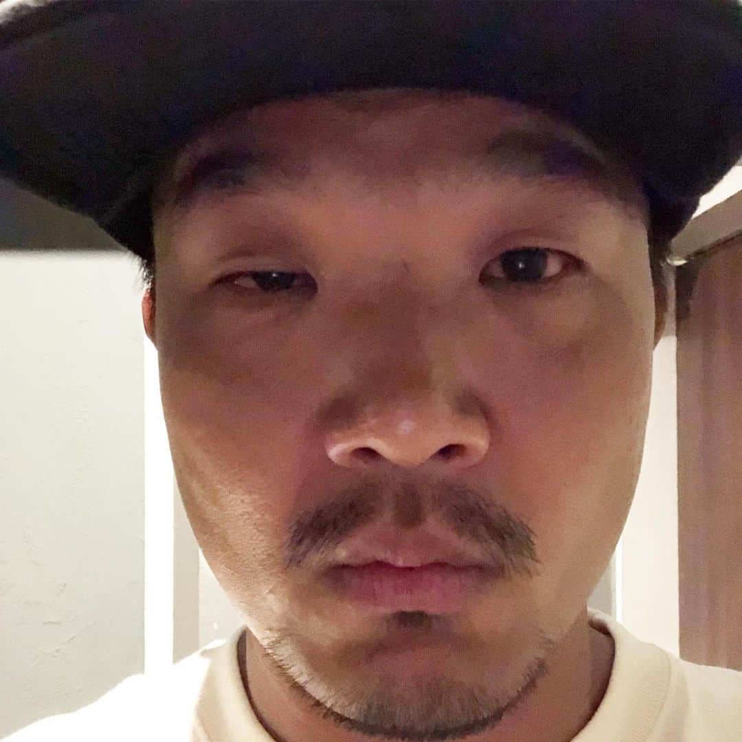 大西宏明さんのインスタグラム写真 - (大西宏明Instagram)「元々ブスやけど…この2週間 超絶ブスになってました😂😭😂😭 やっと復活✨✨✨✨ #殴られた #酔っ払い顔 #二日酔い  #そんなんちゃいます #結膜炎 ですわ #娘 のやつうつされましてん #ナメてた #エグい #元々やけど #目開けへん #視界ゼロ #超絶ブス #最悪な2週間 #もれなく #息子 #嫁 #全員 #結膜炎家族 #一家団欒眼科 #やっと復活 #見えるって幸せ #ブス写真ですみません #smile #ほなっ！！」9月24日 0時39分 - ohnishi_hiroaki_0428