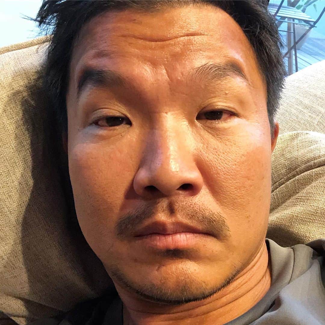 大西宏明さんのインスタグラム写真 - (大西宏明Instagram)「元々ブスやけど…この2週間 超絶ブスになってました😂😭😂😭 やっと復活✨✨✨✨ #殴られた #酔っ払い顔 #二日酔い  #そんなんちゃいます #結膜炎 ですわ #娘 のやつうつされましてん #ナメてた #エグい #元々やけど #目開けへん #視界ゼロ #超絶ブス #最悪な2週間 #もれなく #息子 #嫁 #全員 #結膜炎家族 #一家団欒眼科 #やっと復活 #見えるって幸せ #ブス写真ですみません #smile #ほなっ！！」9月24日 0時39分 - ohnishi_hiroaki_0428