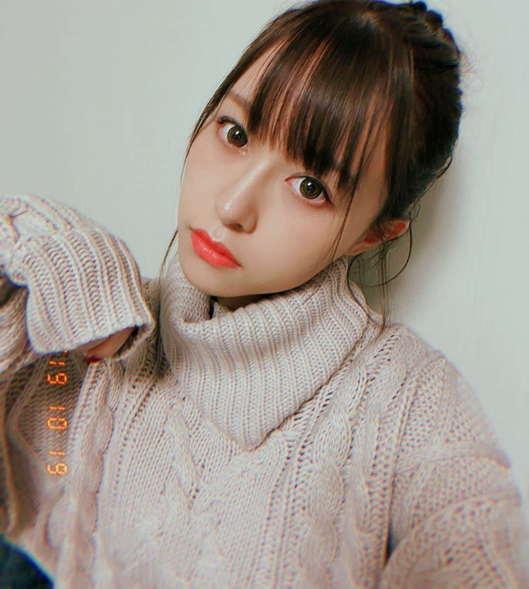歩乃華（ほのらん）のインスタグラム：「髪の毛暗くした！あとイセアクリニックで気になってた白玉点滴とジェネシスやってきた🥺初めて🥺肌ツヤツヤになった！これからちゃんと通いたい🥺」