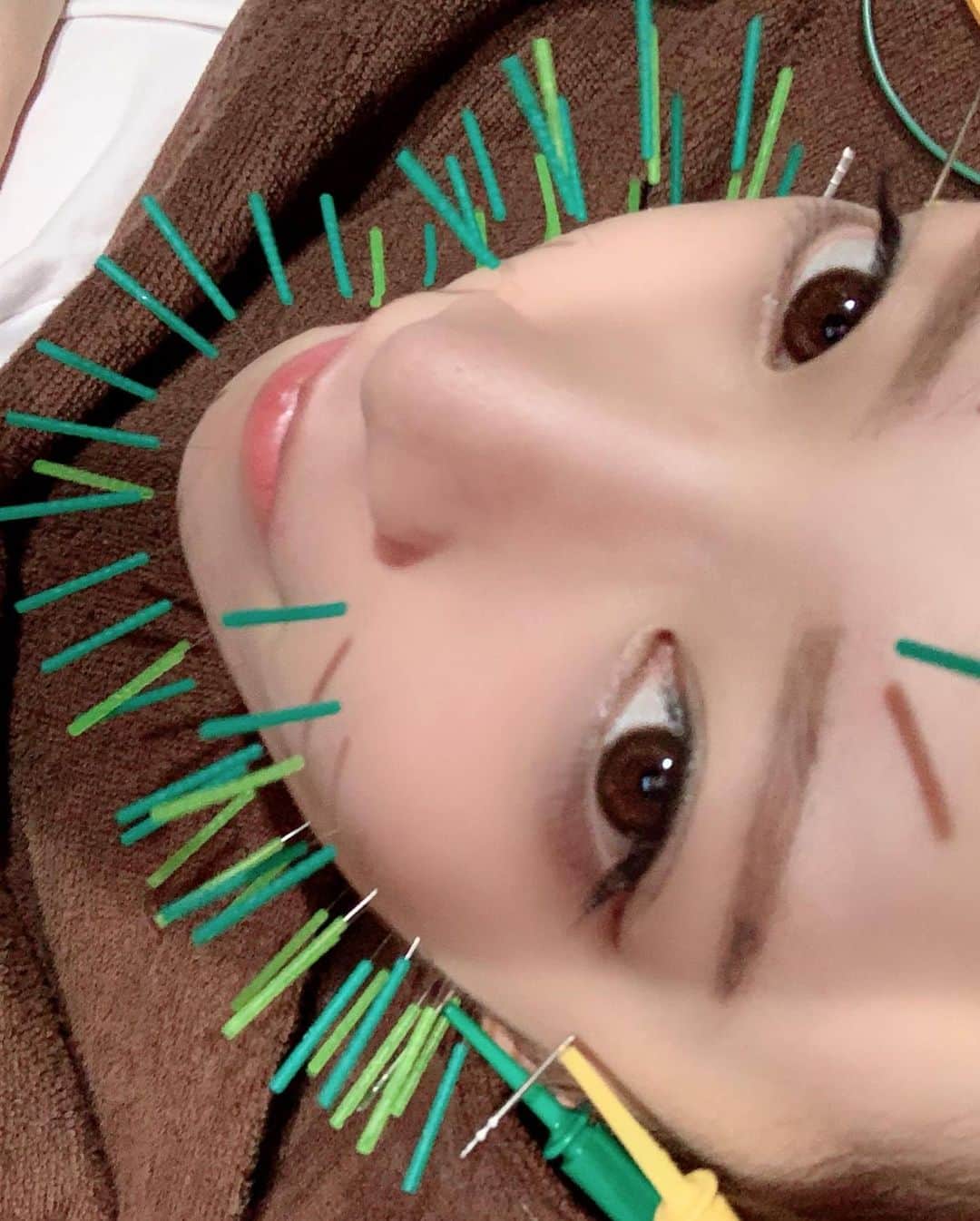 清水あいりさんのインスタグラム写真 - (清水あいりInstagram)「先週ぐらいに？ 美容鍼へ行ってきました。 きゅきゅっと🙈💕 杉崎先生いつもありがとうございます！ #最後の写真髪ボサボサ #なんなら寝起き #鍼の時いつも寝てしまう　 気になる方は先生のアカウントにお問い合わせください✉️ ✉️はこちら@sugizakikenya」10月21日 1時25分 - shimizuairi