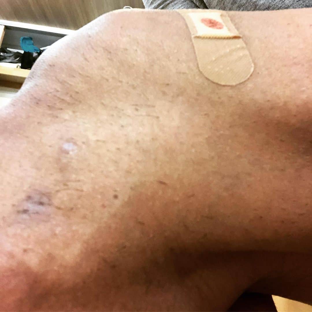 永田裕志さんのインスタグラム写真 - (永田裕志Instagram)「2ヶ月前から左膝に違和感や痛みを感じ始めて、施術、整体等色々と治療してみたが痛み、違和感が中々無くならなかったので精密検査を受けました。半月板か何か損傷があるかと思っていたが、結果は水が少し溜まっていたが、特に悪い損傷箇所はなく50代のレスラーとしては驚異的に良い膝だと診断されました。」9月30日 17時28分 - yuji_nagata