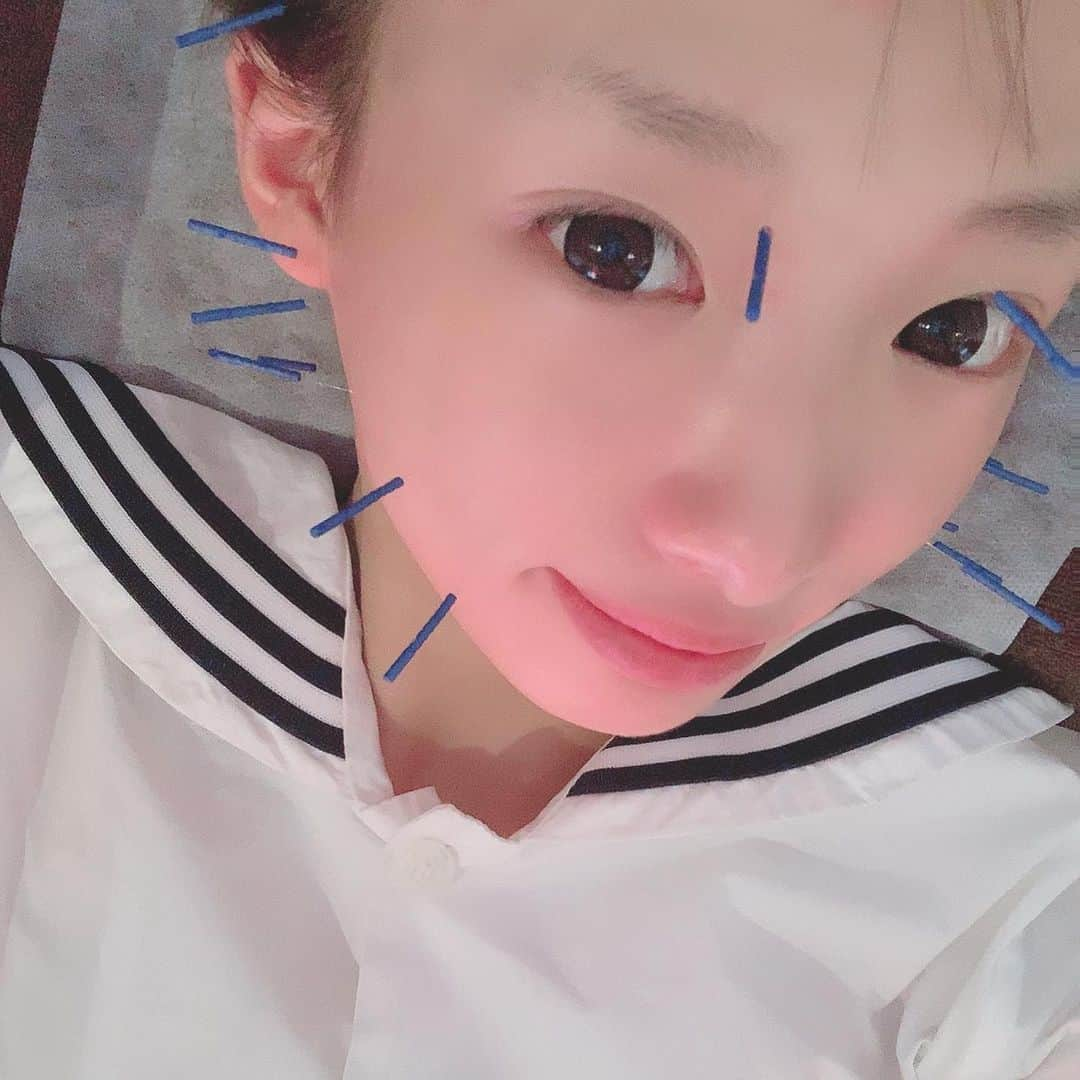 椎名ひかり（ひかりん）さんのインスタグラム写真 - (椎名ひかり（ひかりん）Instagram)「#顔針 #針治療 #FEERIQ  人生初の針に行ってきましたぞ 全く痛くなかった！コリなどがとれてスッキリしました！！ また行くー！！！」10月11日 22時21分 - pikarin_shiina