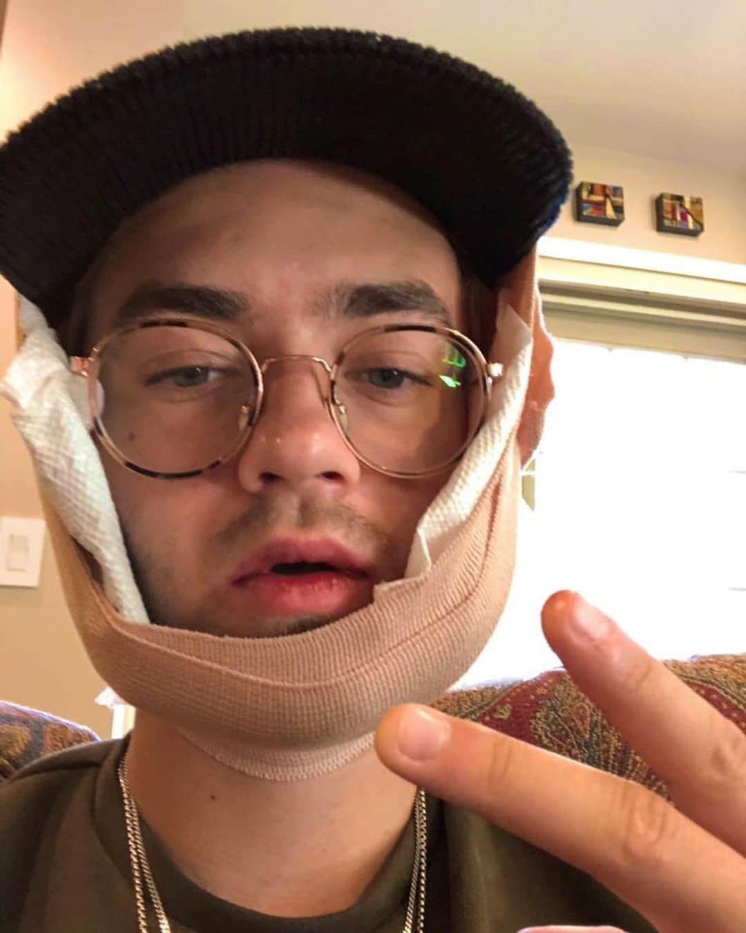 ジャック・ジョンソンのインスタグラム：「Got my wisdom teeth out hope you didn’t miss me too much. And yeah my lips crustier than a tumbleweed after 4 months of tumbling, I know, hop off my dick please.」