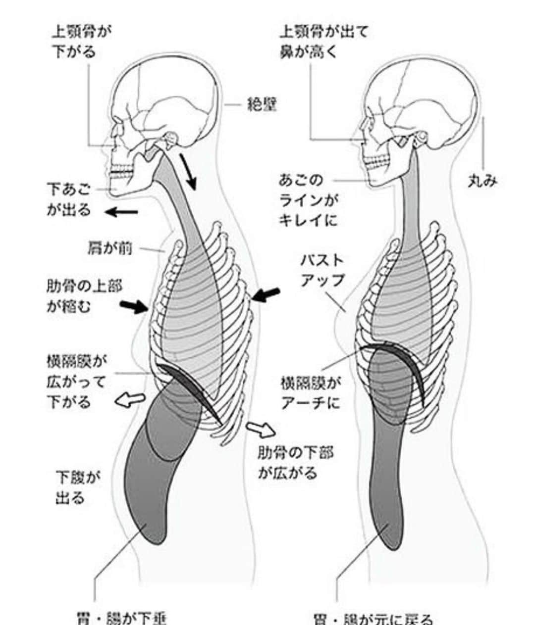 kogao283さんのインスタグラム写真 - (kogao283Instagram)「貴方の姿勢は大丈夫ですか？ 「猫背姿勢でいると横隔膜が使えない」  猫背姿勢で長時間デスクワークをしていると胸部・腹部が圧迫される為　大きく空気を吸い込む事が出来なくなります。  すると　本来呼吸をする度に動いていたはずの「肋骨」をあまり動かさなくなります。 その状態で浅い呼吸をするので筋肉（肋間筋）はどんどん硬くなります。  すると　デスクワークから開放されても猫背の姿勢が保持された状態になってしまいます。 これが「慢性的な猫背」になります。  猫背を予防するには ・「大きな呼吸をする事によって横隔膜を使い　肋骨を動かす（＝肋間筋の伸張・収縮）事により　筋肉を硬くさせない」事が大事です。 ・ ・  #睡眠改善 #睡眠障害 #睡眠負債 #美容情報#女子力#美意識 #ダイエット#アンチエイジング#小顔ヘア#ブライダルヘアメイク #ブライダル前撮り #ブライダルネイル #美容整形#ヨガ#ストレッチ#ジム#リンパマッサージ#スキンケア#ヘアアレンジ#スキンケア#ブライダルエステ#マツエク#カットモデル#体質改善#小顔整形#小顔矯正#温活#妊活アカウント#東京小顔#東京サロン」10月14日 7時50分 - kogao283