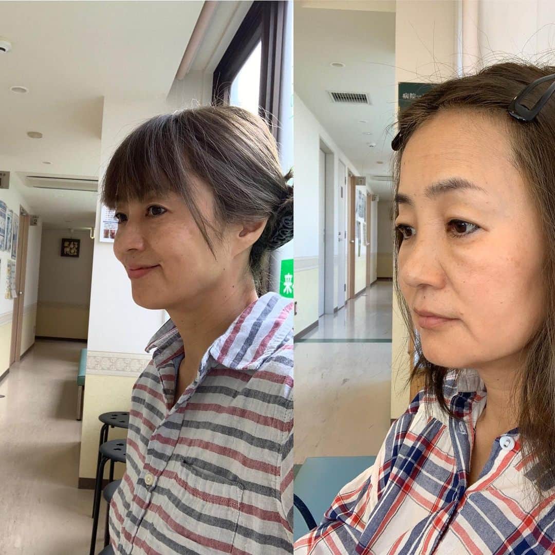 橋本志穂さんのインスタグラム写真 - (橋本志穂Instagram)「顔面崩壊から半月。。 完治しましたー！ ビフォーアフター え？変わらない？？ チーン 笑顔作るという反則技使いましたが、 フェアにするため、どっちもノーメイクは同じです。」10月15日 13時51分 - shihohashimoto3