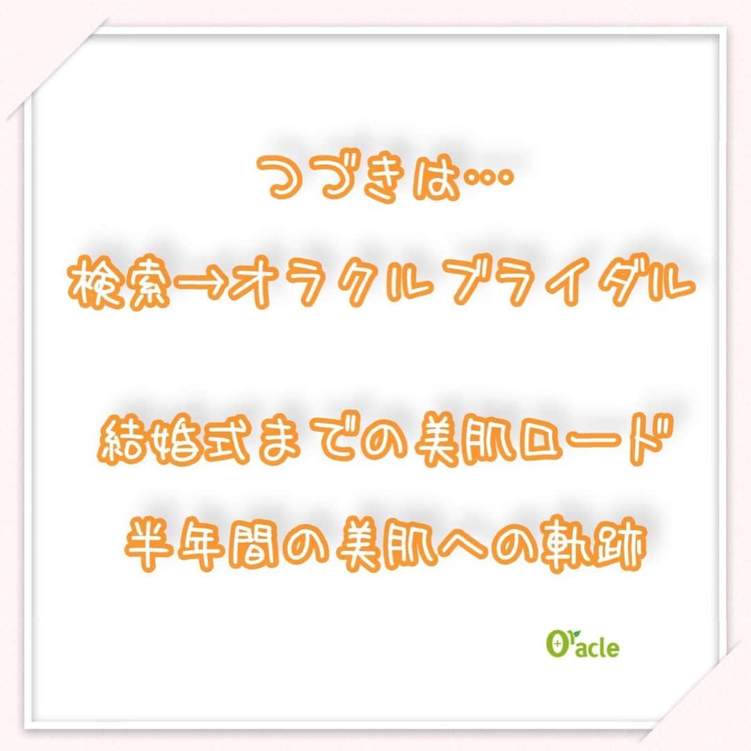 オラクル美容皮膚科東京新宿院さんのインスタグラム写真 - (オラクル美容皮膚科東京新宿院Instagram)「プレ花嫁 結婚式まで美肌になりたい✨  #オラクルブライダル 結婚式前、最後の施術日…  古市院長と半年間の治療とその効果を振り返りました💐 . 💎お肌がとっても白くなり 💎ニキビが良くなり 毛穴は…  続きは 検索📲 オラクルブライダル で  タイトル：結婚式までの美肌ロード 👰  DMいただけましたらURLお伝えいたします。 いつもたくさんのDMありがとうございます🙇‍♀️ . ブライダル美容相談👰承っております . ♡♡♡♡♡♡♡♡♡♡♡﻿ ﻿ 🇯🇵オラクル美容皮膚科🇰🇷﻿ 📍新宿3丁目19-4 MLJ新宿8階﻿ ﻿ 【専門】﻿ ニキビ（跡）／毛穴／シミ／しわ／たるみ／痩身／アンチエイジング／美白美肌治療全般／ブライダル相談﻿ ﻿ 🗝完全予約制﻿ 👠土日祝日も診療﻿ ﻿ 【予約方法】﻿ ☎0120-905-696﻿ ⏰9:00～21:00［年中無休］﻿ ﻿ LINE、メール24時間📧﻿ LINE🆔 @oracle.jp ﻿ 📩HPメールフォームよりお願いいたします﻿ ﻿ ▪️▫️▪️▫️▪️▫️▪️▫️▪️▫️﻿ #オラクル美容皮膚科 #オラクル #美容皮膚科  #美肌 #美白 #美活 #美容﻿ #美白になりたい #美白ケア #ツヤ肌 #ピーリング #皮膚管理 #鎮静管理 #メディカルエステ #スキンケア #ニキビ #毛穴  #美白管理 #再生管理 #イオン導入 ﻿ #韓国美容  #美容女子  #プレ花嫁 #ブライダルエステ #日本中のプレ花嫁さんと繋がりたい #プレ花嫁準備  #結婚式準備」10月16日 9時04分 - oraclejp