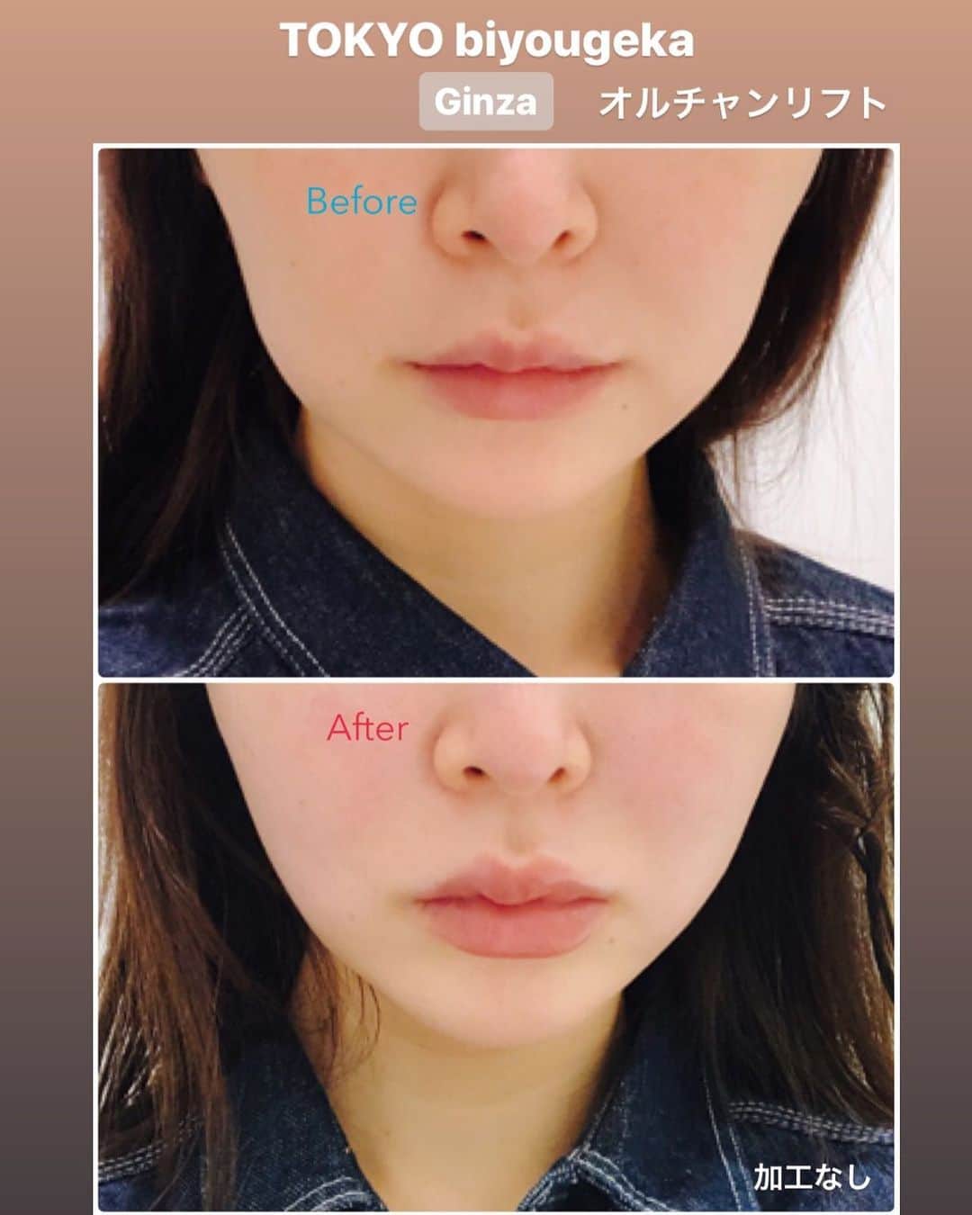 東京美容外科公式のグルメインスタ