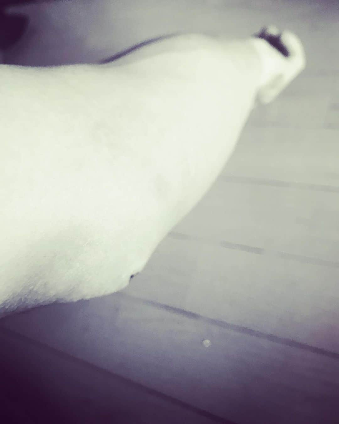 小山田大さんのインスタグラム写真 - (小山田大Instagram)「The wounded elbow was hurt again about 5days ago, and the wound was infected with bad bacteria. Currently being treated with antibiotics. Unfortunately I can't climb for a while, but I have to concentrate on treatment.」11月14日 12時40分 - dai_koyamada