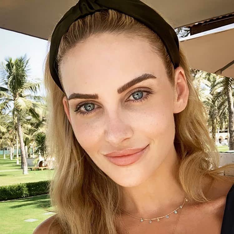 ステファニー・プラットのインスタグラム：「I got some new freckles 😁🤓」