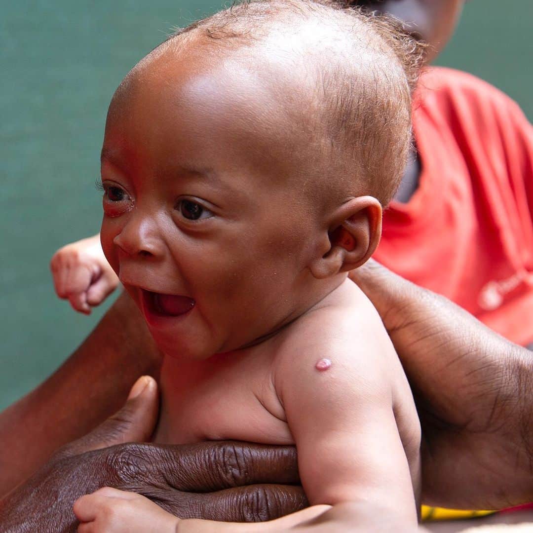 国境なき医師団さんのインスタグラム写真 - (国境なき医師団Instagram)「さあ、調子はどうかな？ 今から、国境なき医師団の病院で産後の検診です。 . 約10万人のブルンジ難民が暮らしている、タンザニアのンドゥタ難民キャンプ。ここでは、新しい命もたくさん生まれています。 . 国境なき医師団は産前から産後まで、お母さんと赤ちゃんのためのケアを提供。検診や診療を行うだけでなく、ときには健康教育のスタッフが、沐浴のしかたなど健康に暮らすための情報を伝えます。 . 過酷な生活を強いられる難民キャンプで、家族を守りたい！　そんな思いの人びとが、今日も国境なき医師団の病院に集まります。 ------------------------------------- タンザニアの活動ニュースは公式サイトから。プロフィールのURLリンクからどうぞ→@msf_japan . -------------------------------------- Photo © Ellie Kealey/MSF #国境なき医師団 #MSF #タンザニア #子ども #産後 #赤ちゃん #検診 #ママと一緒 #photooftheday #笑顔 #スマイル #元気になる #写真部 #写真好きな人と繋がりたい」11月1日 11時02分 - msf_japan