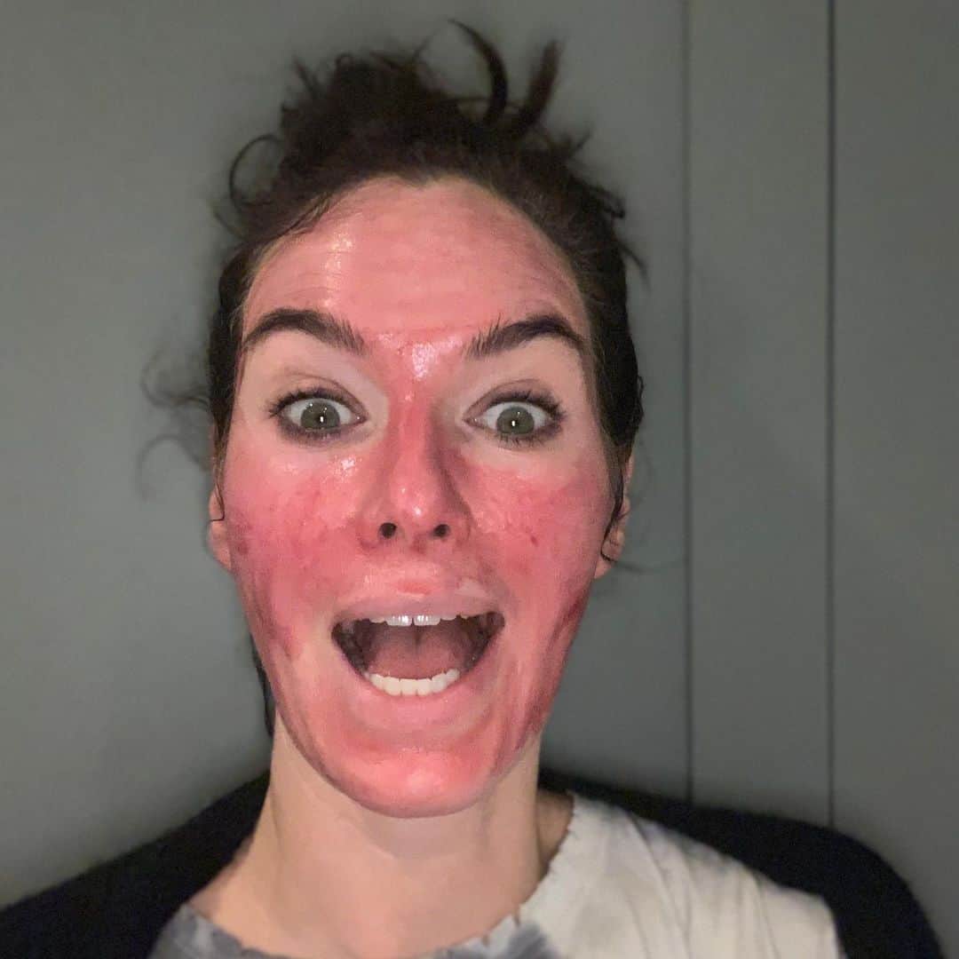 レナ・ヘディのインスタグラム：「@sammykinns LETS HOPE THIS WORKS ..... 😬😂😂😂👹👹 #theordinary」