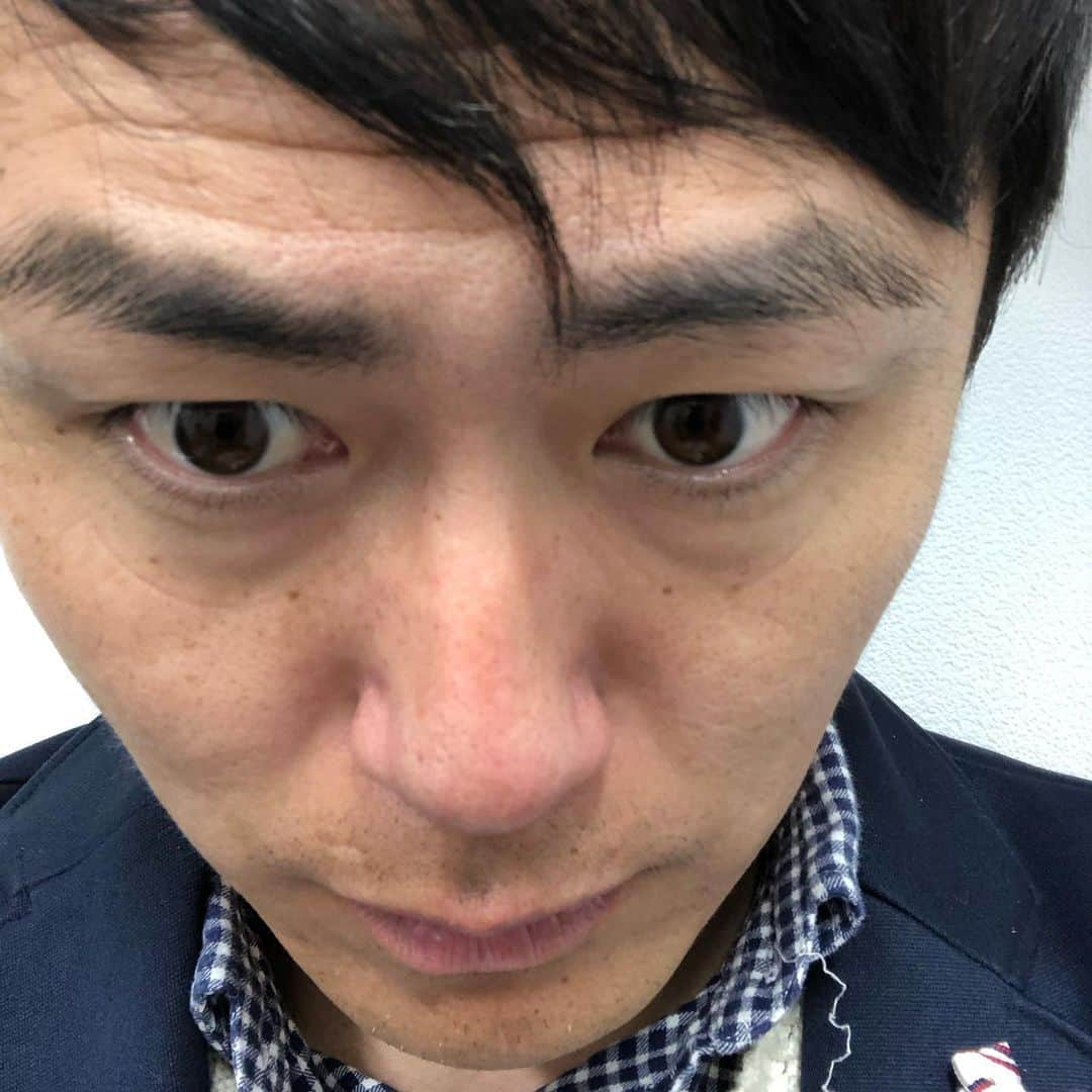 梅村賢太郎さんのインスタグラム写真 - (梅村賢太郎Instagram)「ゴリラ洗顔させて頂きました！ 施術前→施術後 を交互にこちらアップしてます スワイプして見てみて下さい！ トーンがあがりました！ すごい！ 7枚目は元々透明やったものに 僕の顔の汚れが入ったもの💦 グレープフルーツジュースくらいなった！ 失礼します😢  #ゴリラクリニック #心斎橋 #梅田 にもできるそうです 施術前に相談受けてくれはるから安心！ お肌ケアの方法も教わりました！ ありがとうございました！  スタッフの方々がまた美人様 はい。僕しどろもどろ。」11月12日 19時56分 - rahujigenume