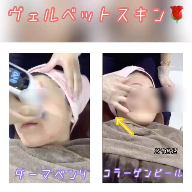 オラクル美容皮膚科東京新宿院のインスタグラム