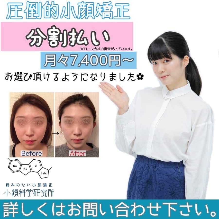 小顔科学研究所 さんのインスタグラム写真 - (小顔科学研究所 Instagram)「【小顔になるには頭皮ケアも大切！】﻿ ﻿ お顔と頭は一枚の皮で繋がっています。﻿ だからこそお顔だけではなく、頭部のケアも﻿ とっても大切です☺︎💎﻿ ﻿ 頭頂部には帽状腱膜（ぼうじょうけんまく）という﻿ 筋膜があります。﻿ そして、前頭筋、側頭筋、後頭筋の﻿ ３つの筋肉と繋がり合っています。﻿ この３つの筋肉は、頭部の血液を流す﻿ ポンプの役割をしています。﻿ ﻿ だから頭皮がカチカチに凝り固まると、﻿ このポンプ機能が働かず、血行不良に💦﻿ 帽状腱膜もピーンと引っ張られ、﻿ 頭蓋骨に張り付いてしまいます。﻿ ﻿ その結果、老廃物が溜まり、﻿ 顔がどんどんむくみ、輪郭がたるんでしまうのです💆‍♀️﻿ ﻿ ブラッシングをする事で、﻿ 凝り固まった頭皮に刺激を与え、﻿ 血行を良くしてあげましょう✨﻿ ﻿ 朝晩2回、下から上へ生え際から﻿ 頭頂部に向かってブラッシングするのがオススメです♪﻿ ﻿ 目の疲れにも効果的です👁✨﻿ ﻿ いつも普通にやっているブラッシングですが、﻿ 意識して小顔への近道を🌱﻿ ﻿ ﻿ 小顔科学研究所では﻿ ついに！ご要望をたくさん頂いていた﻿ 人気の圧倒的小顔矯正、﻿ 圧倒的小顔矯正フルコースの﻿ 分割払いの受付スタート致しました⭐️﻿ ﻿ 月々7,400円〜ご案内可能です！﻿ ﻿ ぜひお問い合わせお待ちしております！﻿ ﻿ .﻿ ┈┈┈┈┈┈┈┈┈┈┈┈┈┈┈┈┈┈ ﻿ #小顔 #小顔矯正 #骨盤矯正 #小顔科学研究所 #痛くない小顔矯正  #小顔効果 #小顔はつくれる #芸能人御用達 #美容 #整体 #美容整体  #顔の歪み #むくみ #たるみ  #表参道小顔矯正 #名古屋小顔矯正 #美容鍼 #歪み　#キャンペーン #モニター募集中 #分割払い ﻿」11月19日 13時19分 - kogaokagaku