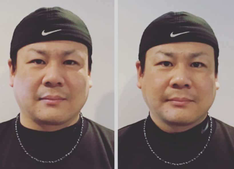 増渕竜義のインスタグラム：「今日の小顔矯正笑 徐々に小顔目指します！笑 ↓ちいさな整体院↓ https://rac-n.com/  引き続き僕の投稿を見たと言ってもらえると割引されます^ - ^  #野球#スポーツ#プロ野球#増渕竜義#整体#赤羽#ちいさな整体院」