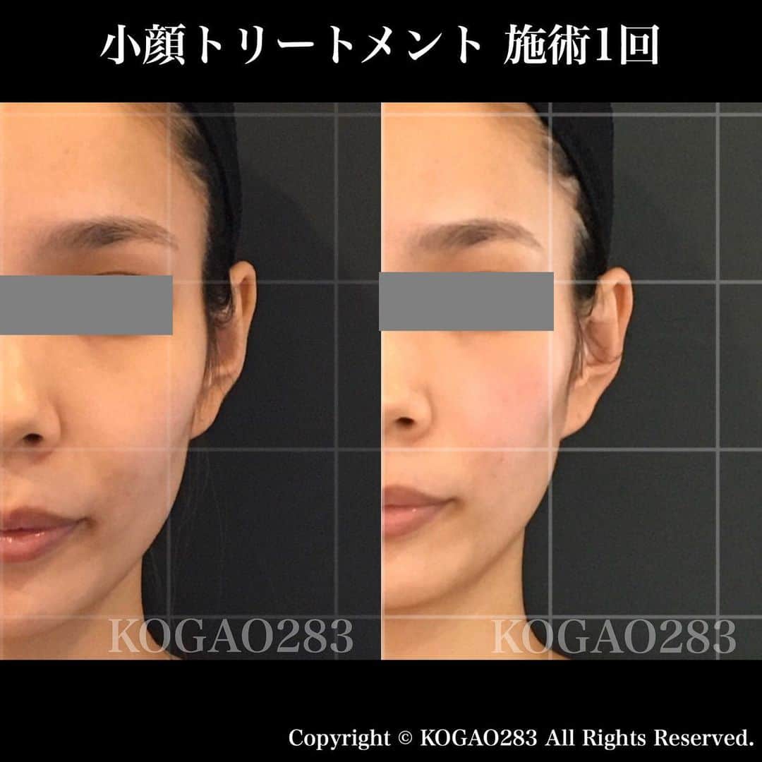 kogao283のグルメインスタ