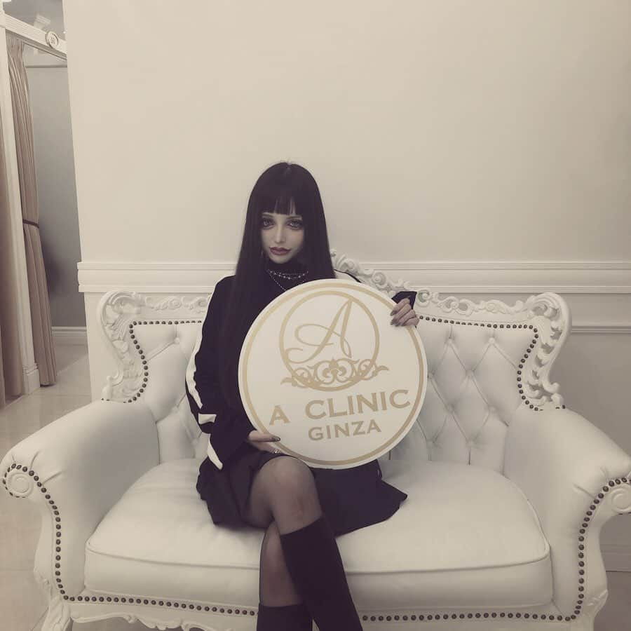 chiiiiiさんのインスタグラム写真 - (chiiiiiInstagram)「先日は(@a_clinic_ginza )さんで #Aスレッド　を受けてしました 経過は1,2ヶ月かけてどんどん変化が出てくるとのことだったので楽しみ❤︎皆さん優しくて居心地良かった..( ◜◡◝ ) 担当は小松先生(@dr.komatsu_rui )で す💋  #aclinic #aclinic銀座 #aクリニック#美容#小顔#美肌#リフトアップ#美容外科#美容皮膚#美容クリニック#小松塁」11月24日 11時36分 - xchix328