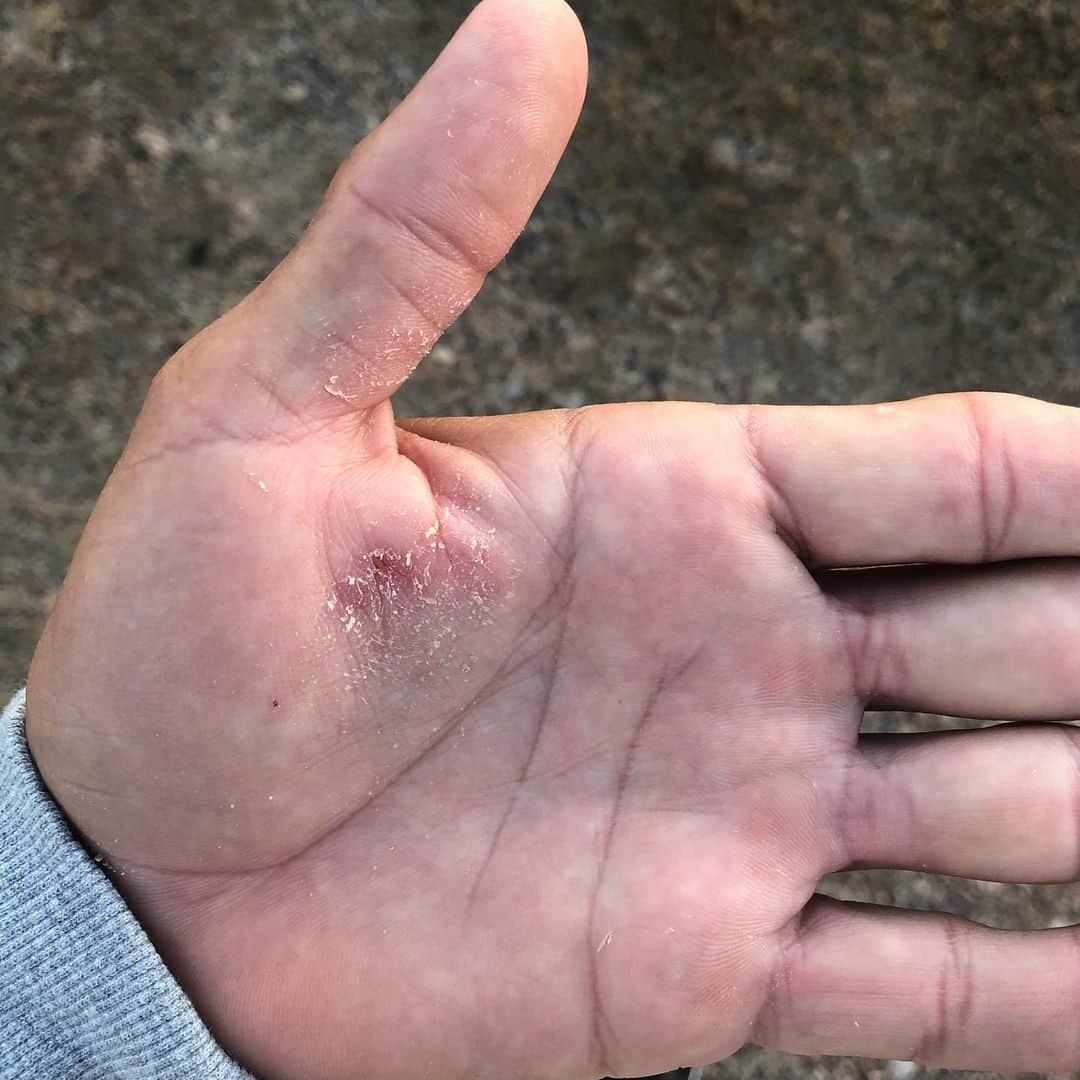 Brent Ehrlerさんのインスタグラム写真 - (Brent EhrlerInstagram)「Lake Baccarac bass thumb/palm. When your palm hurts, you know they’ve been big. @yamamoto_fishing @lakebaccaraclodge」11月24日 22時49分 - brentehrlerfishing