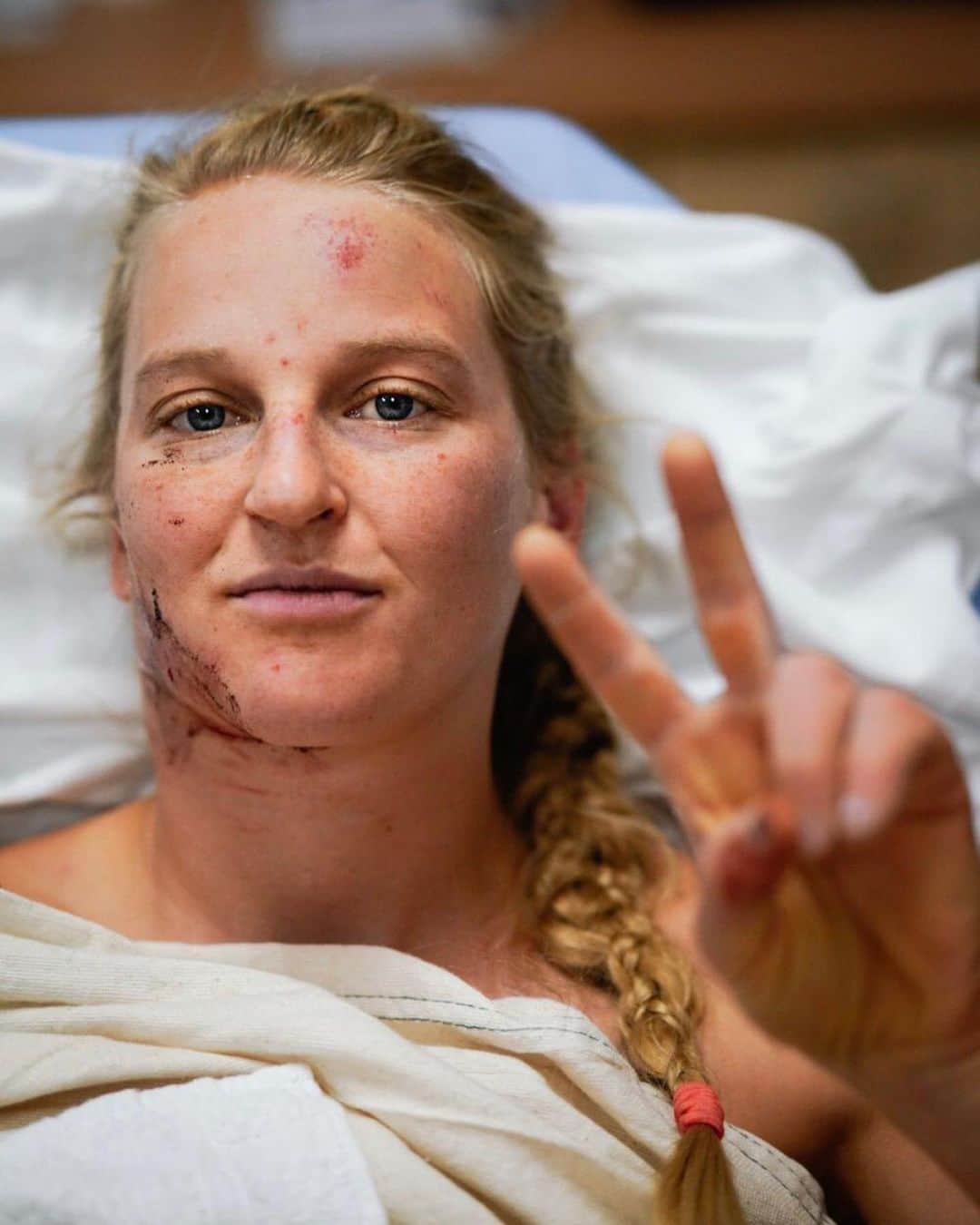 エミリー・ハリントンのインスタグラム：「I had an accident yesterday on El Cap. I’m banged up but gonna be ok thankfully.  Not much to say except I took a bad fall and pin balled a bit then somehow hit the rope w my neck - 🤷🏼‍♀️🤦🏼‍♀️ All I know is that I am extremely grateful to have had @adrianballinger @alexhonnold @jonglassberg @sannimccandless @tarakerzhner and YOSAR of course there to get me out and help me through ❤️ // thanks everyone who sent kind messages and thoughts - feeling so supported and loved 💕 // 📸 portrait by @tarakerzhner + neck selfie」
