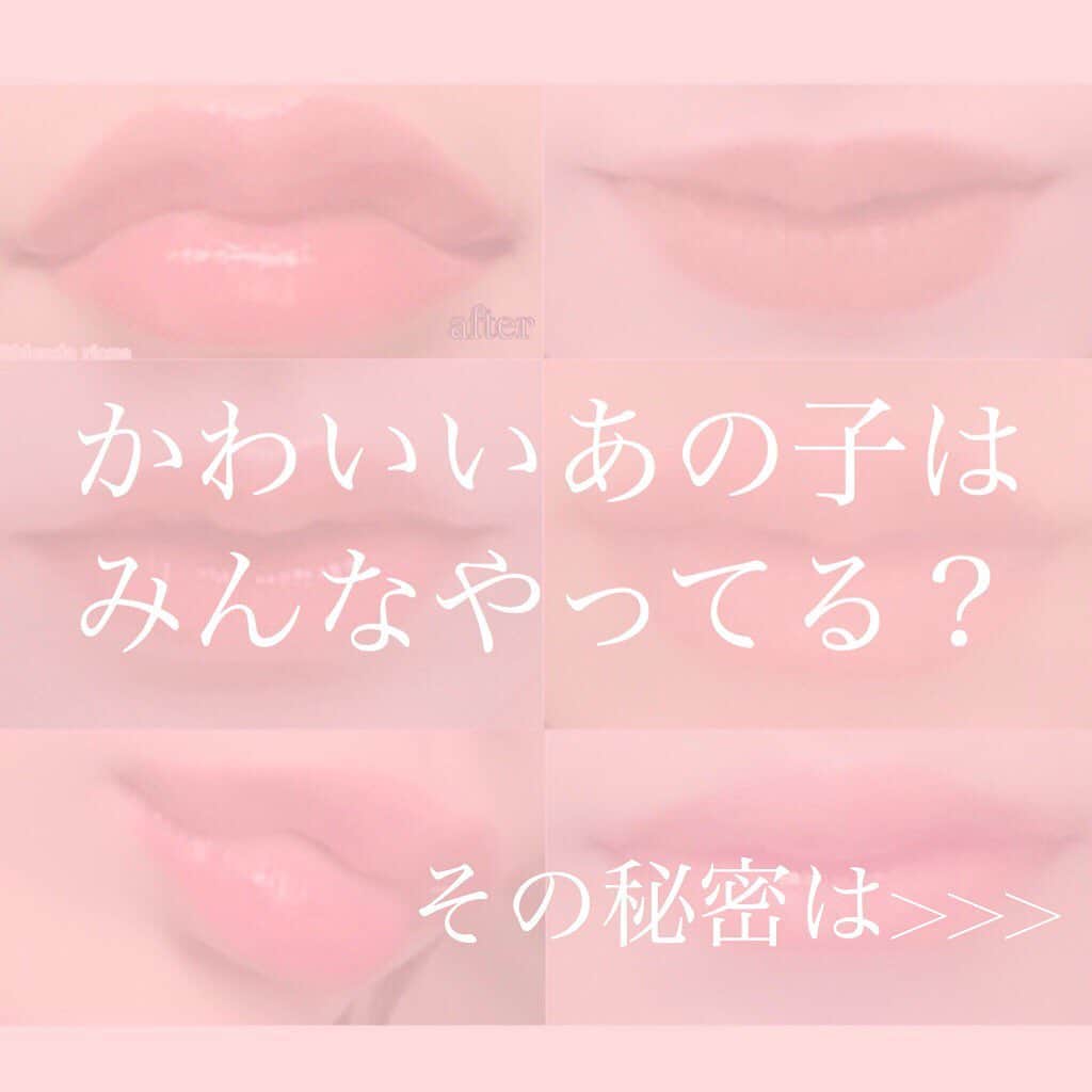 恵比寿フィラークリニックのインスタグラム