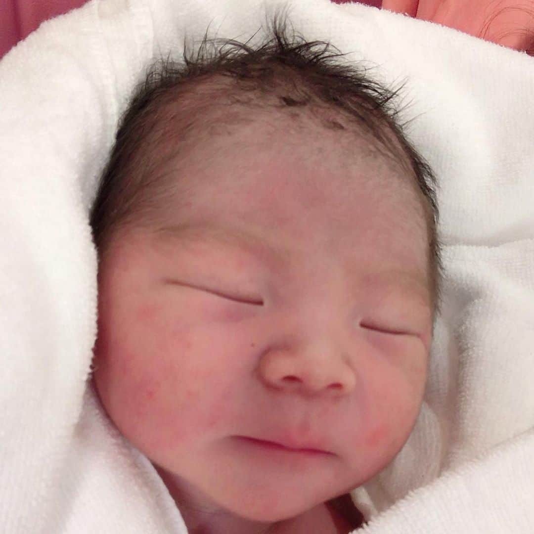 野口綾子さんのインスタグラム写真 - (野口綾子Instagram)「11.22 結婚１年記念日に産まれました👶💕 3295g 元気な男の子です。 . 遅くなりましたが、やっと少し落ち着いたので。 . 赤ちゃんはすこぶる元気健康です！ その替わり、私の恥骨をボキンッガキンッと折って出てきたので、普通に歩けるようになるまで2か月はかかるそう😂 . 恥骨結合離開というそうです。意外なことに、私は骨盤が普通の人より狭いんだそう(逆に大きいと思っていたのに…) でもそのお陰で、息子くんは元気に引っ張り出してもらえました！  もうあとは治るだけなので、とっても気楽です👍 こんなに可愛い子に出会えるなら、私の恥骨の一個や二個折れていーやと思える程、かわいいです😍 . #出産　#高齢出産 #恥骨結合離開  #息子 #鉗子分娩　#赤ちゃん #全治2ヶ月 #骨折 #無痛分娩　 #男の子ベビー #男の子ママ #男の子  #親バカ部ig_baby  #親バカ部 　#0歳　#新米ママ　#ベビー　#成長記録　#育児記録　#息子　#乳児 #赤ちゃん #赤ちゃん写真 #こそだてぐらむ #赤ちゃんのいる生活」11月26日 21時02分 - ayako__n