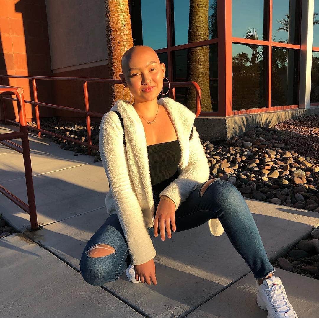 Instagramさんのインスタグラム写真 - (InstagramInstagram)「“I decided that being bald isn’t going to hold me back,” says 16-year-old Miah Griffith (@miahcgriffith), who was diagnosed with Type 1 diabetes at the age of 10, then alopecia a year later. “It really affected my life the first few years of getting used to it. I never really knew if people were friends with me for me, or out of sympathy,” she says. “Now, I’m confident in my own skin, and I feel like I rock being bald. I enjoy my baldness and the stares from other people don’t affect me much. I know that I’m beautiful the way I am, and no one can say otherwise.”⁣ ⁣ Photo by @miahcgriffith」11月28日 3時15分 - instagram