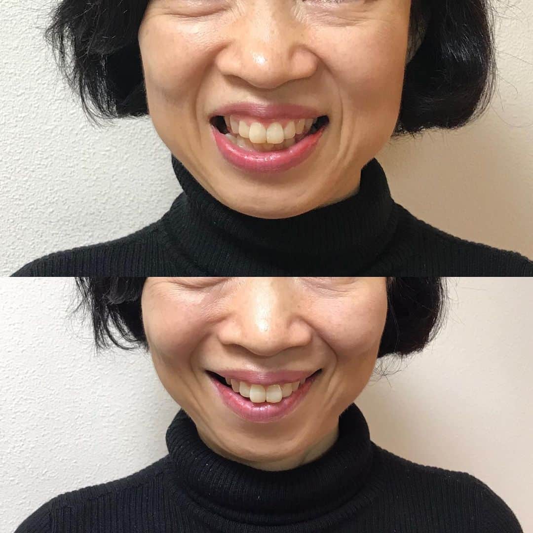 間々田佳子のインスタグラム：「自分の筋肉と話し合うと このような結果となる😆😊💕 #間々田佳子 #表情筋トレーニング #表情筋トレーニング成果大　 #顔ヨガ」